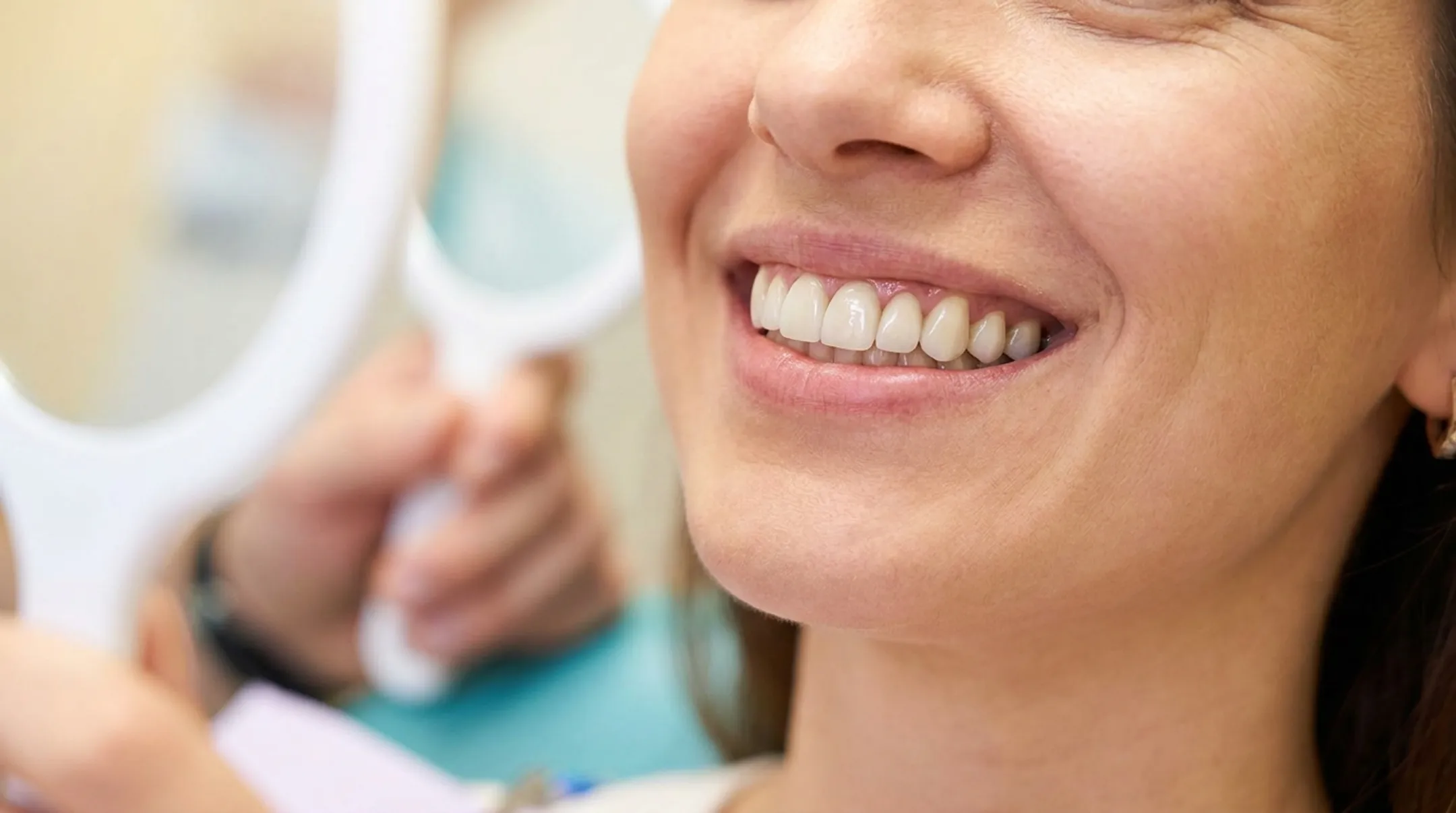 Before and after smile transformation from combined implant and veneer treatment