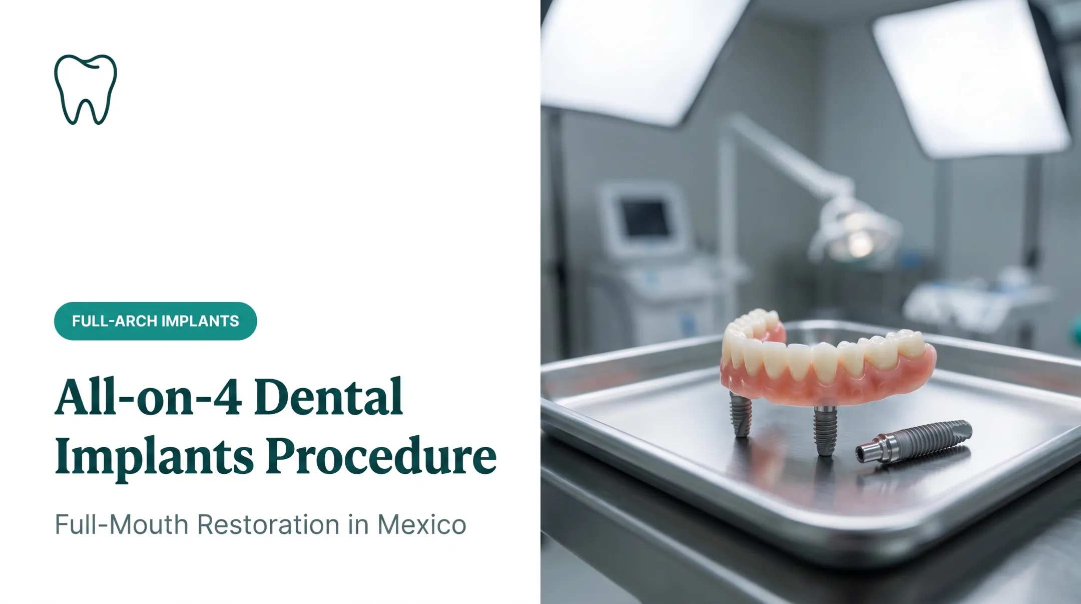 All-on-4 Dental Implants Procedure