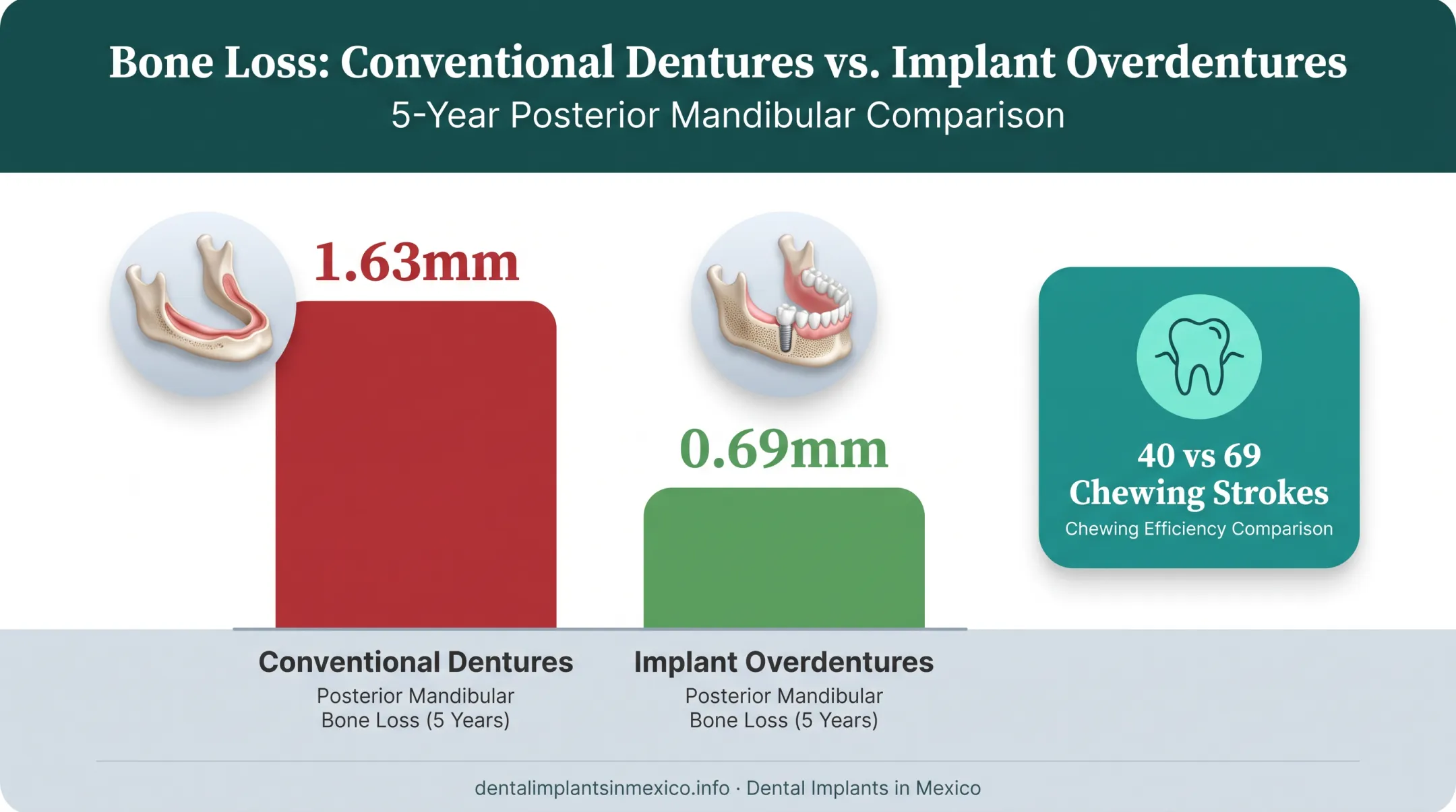 Bone loss comparison chart implant overdentures versus conventional dentures over five years