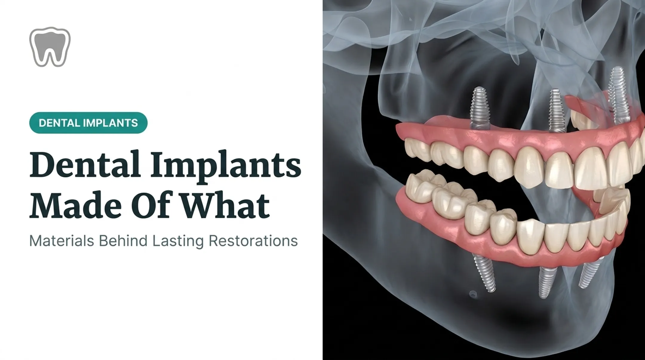 Dental Implants Made Of What