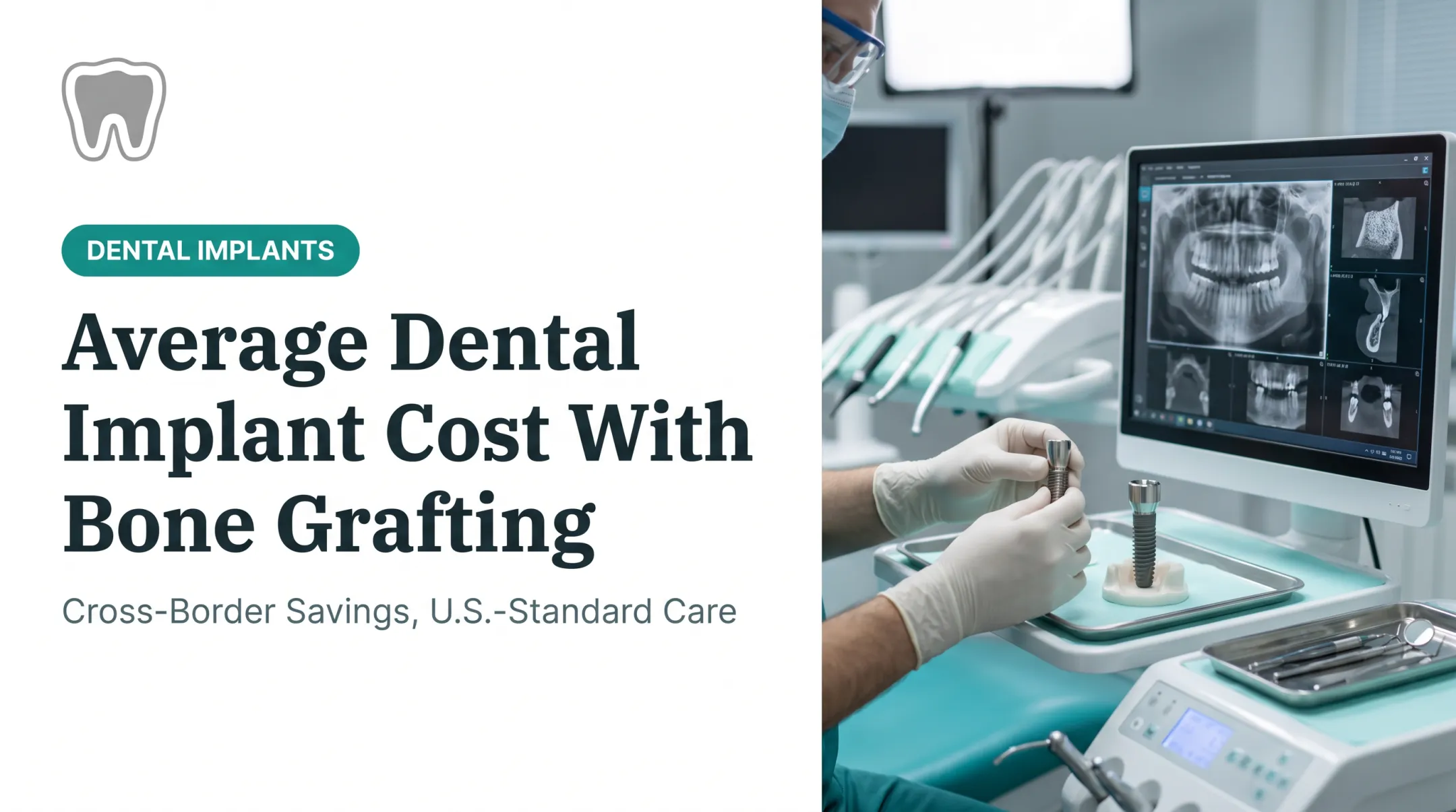 Average Dental Implant Cost With Bone Grafting