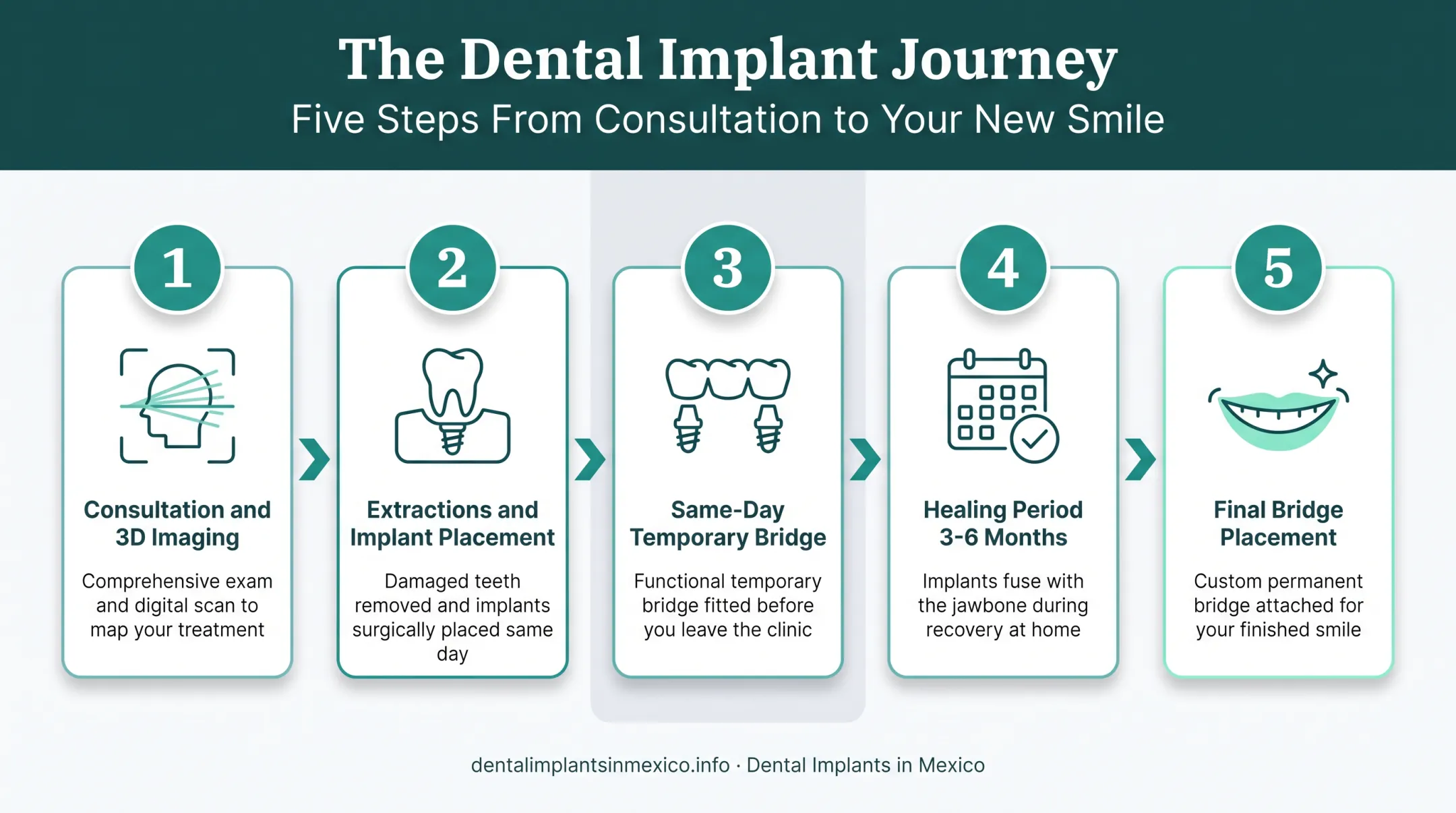 5-step All-on-4 dental implant procedure timeline from consultation to final bridge