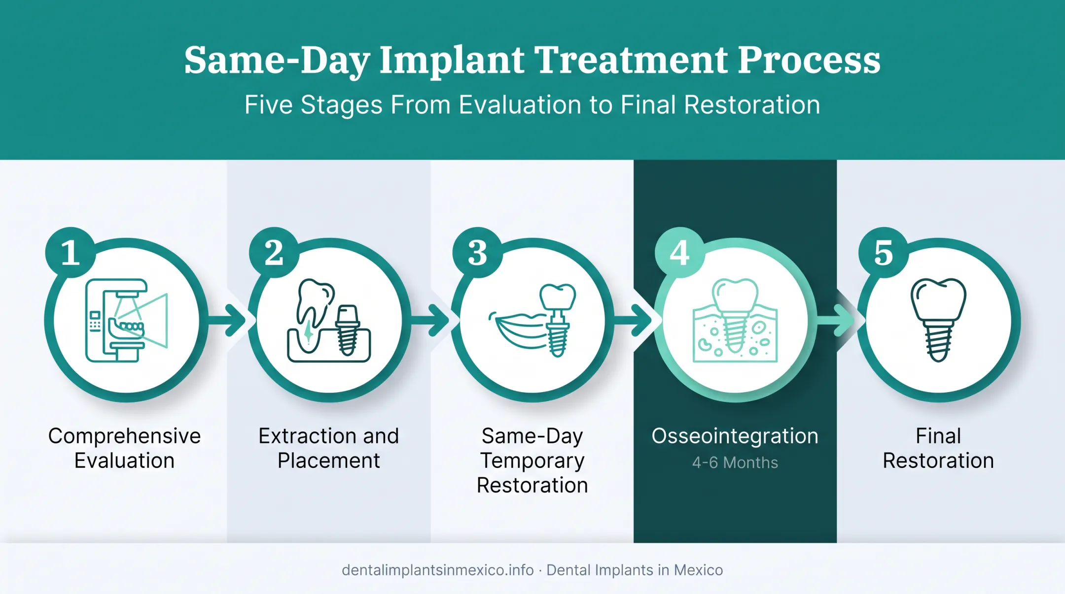 5-step same-day dental implant process from evaluation to final restoration