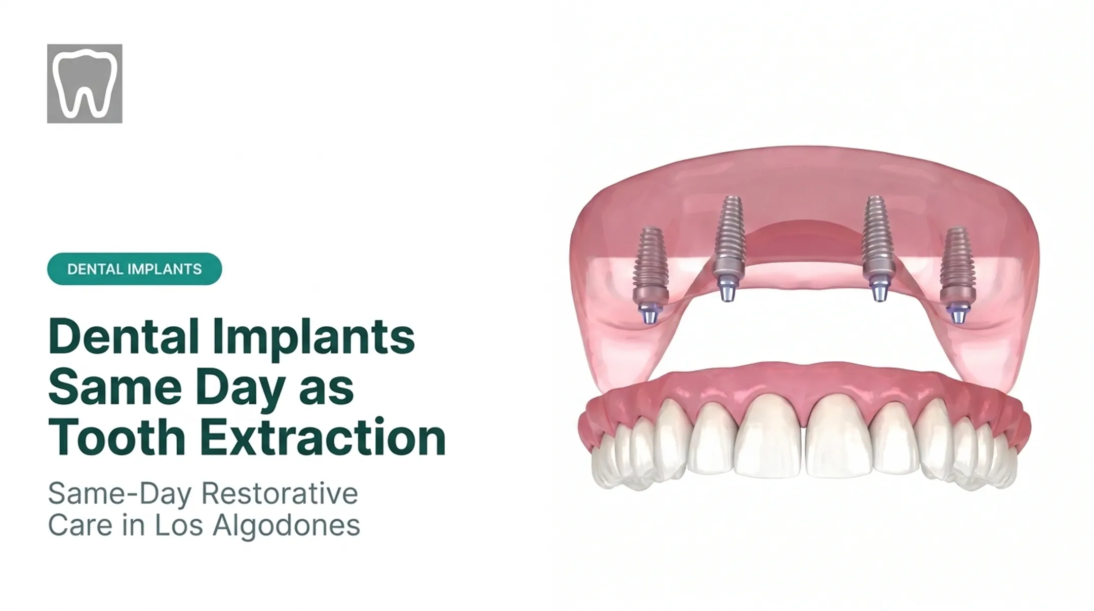 Dental Implants Same Day as Tooth Extraction