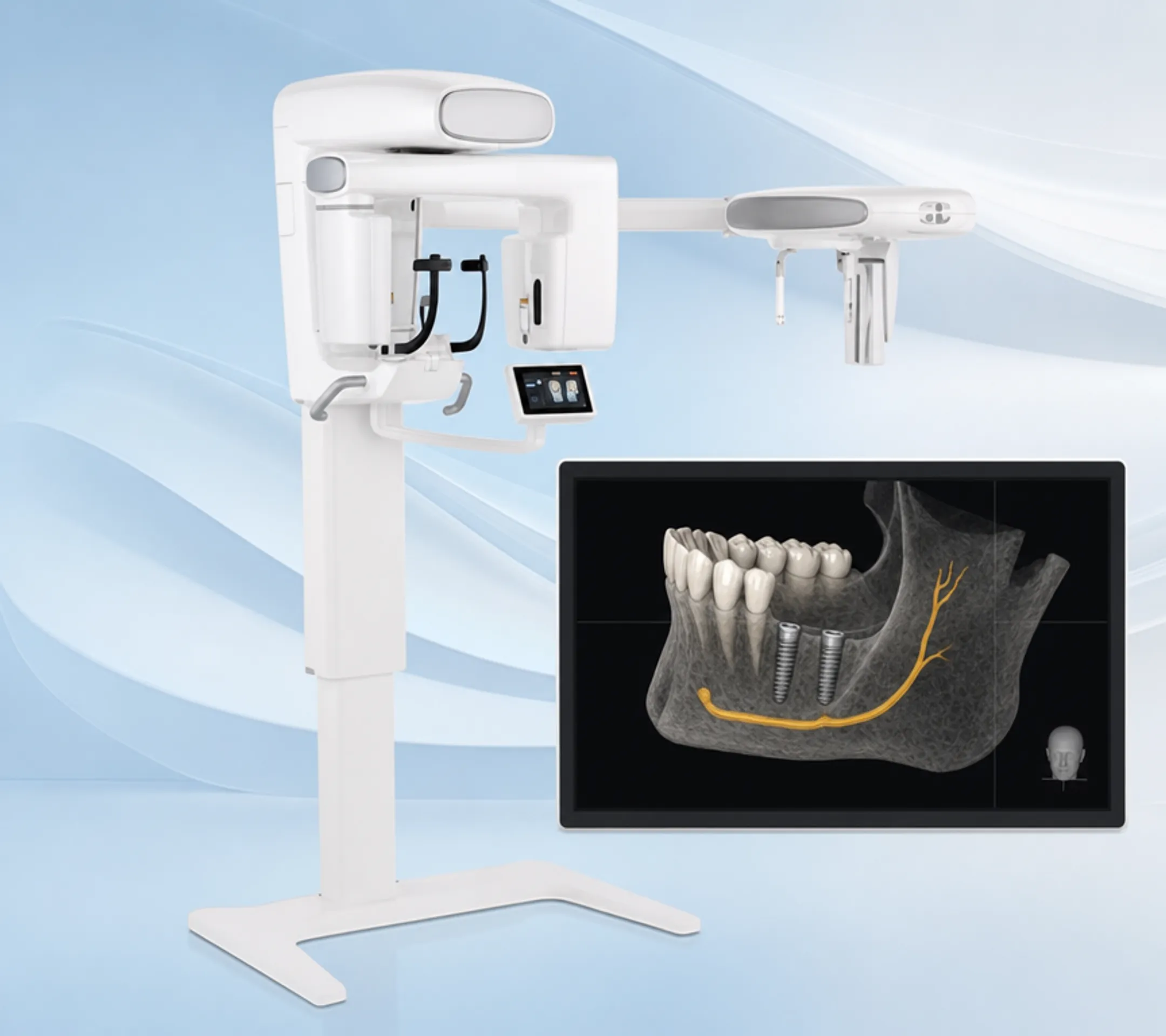3D Cone Beam CT scan imaging equipment used for dental implant planning