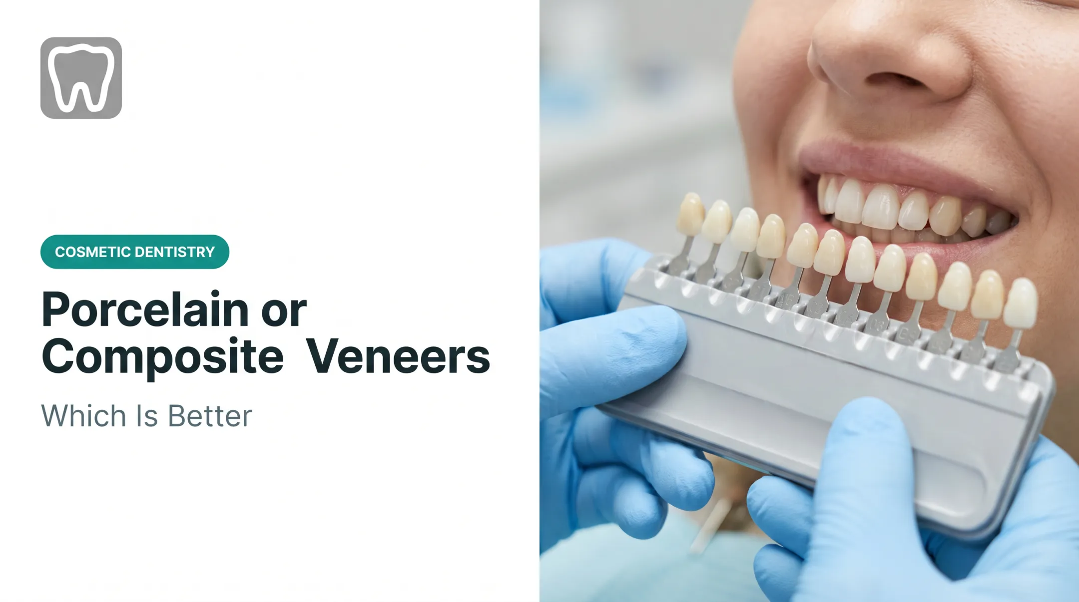 Porcelain or Composite Veneers: Which Is Better