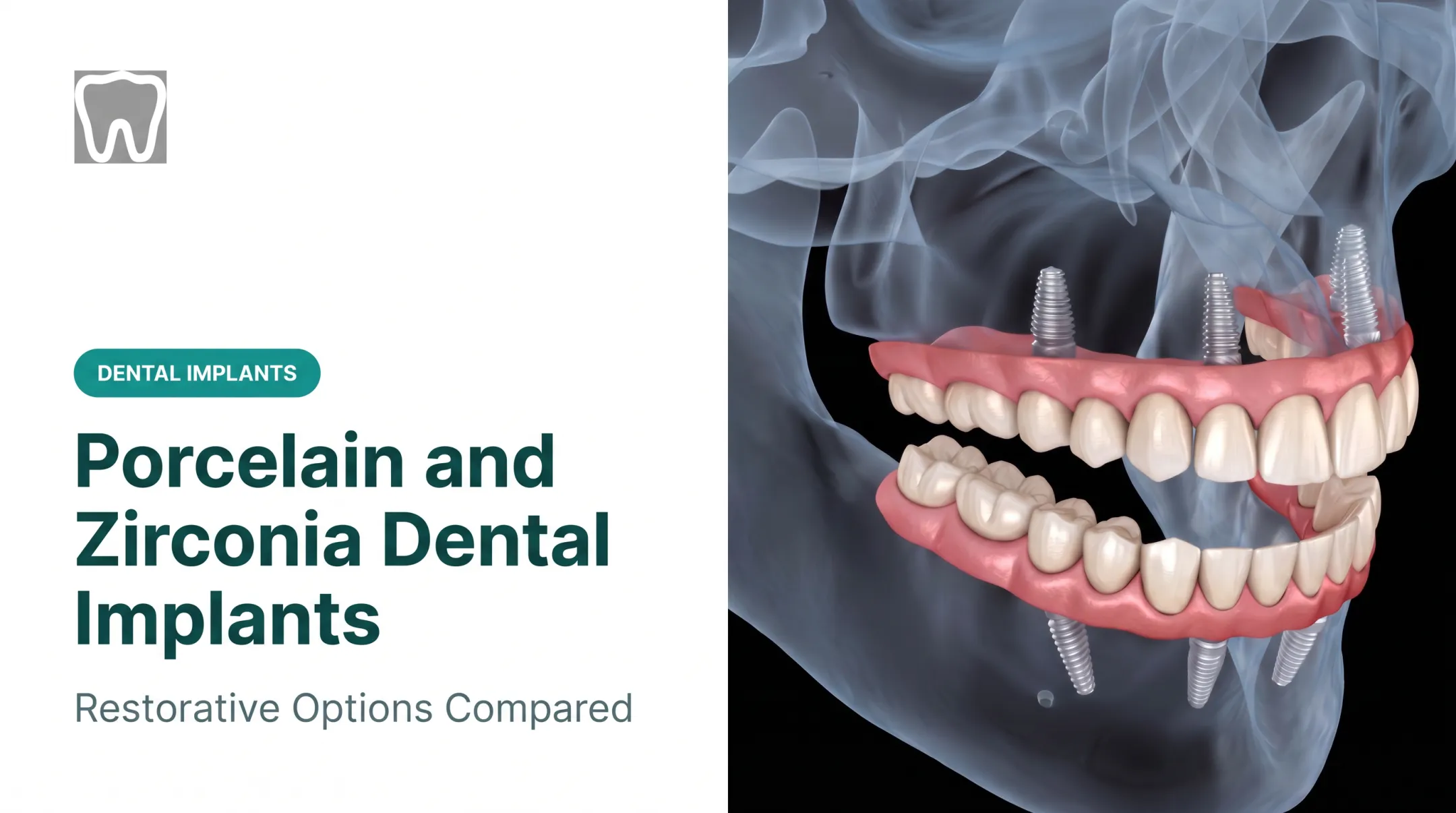 Porcelain and Zirconia Dental Implants