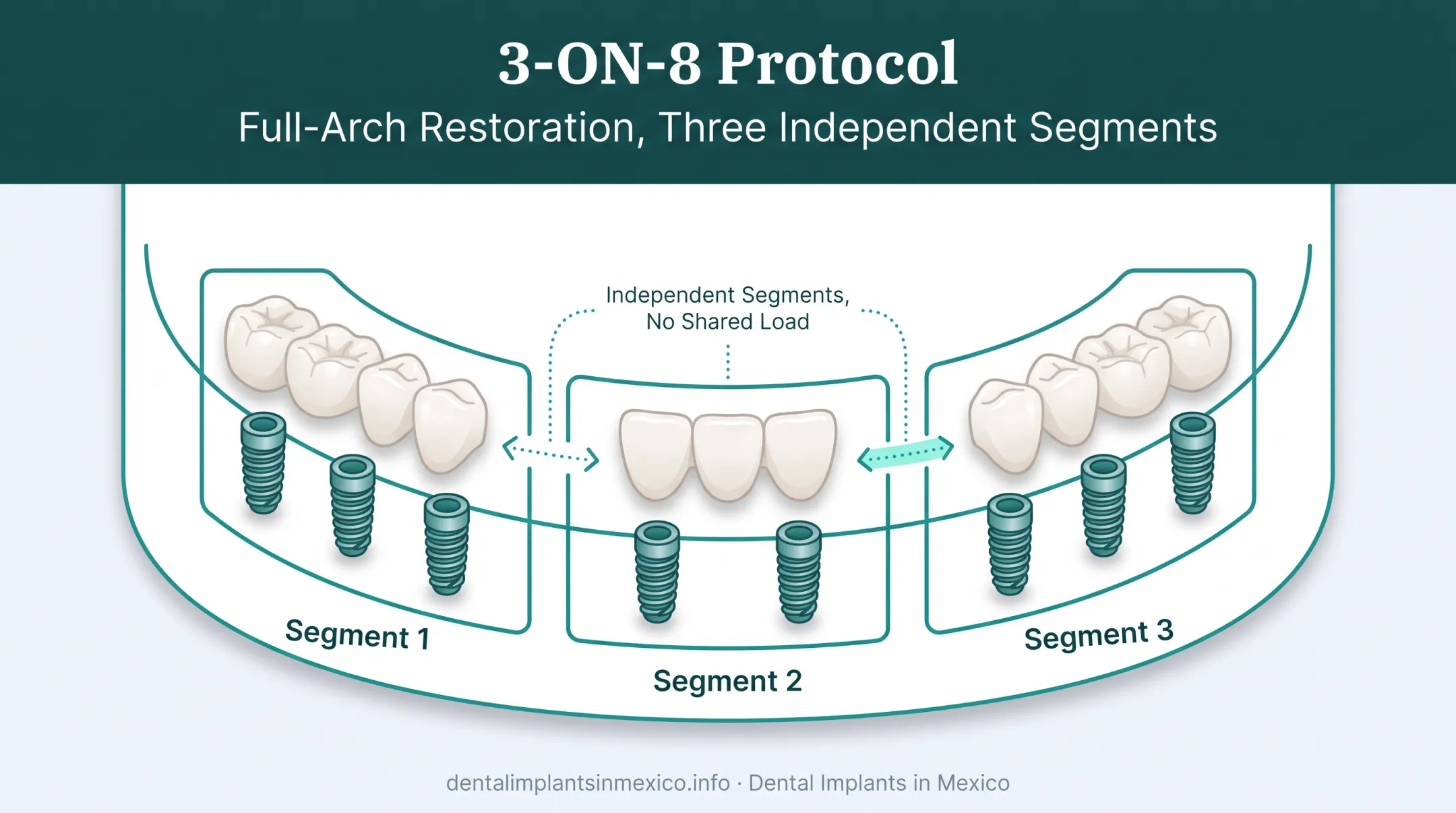 3-ON-8 protocol diagram showing eight implants and three zirconia bridges