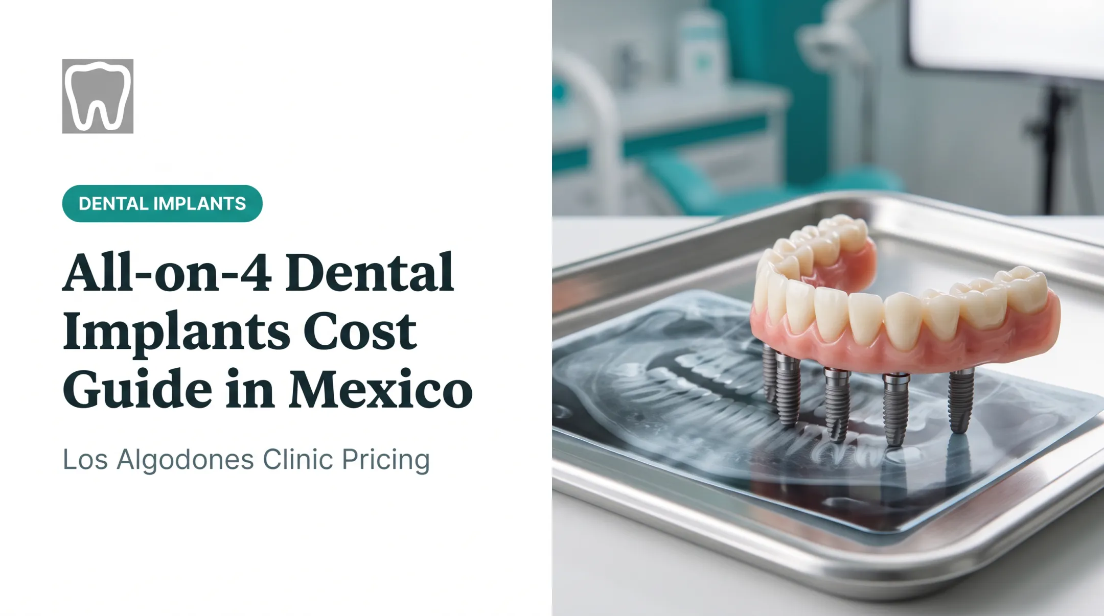 All-on-4 Dental Implants Cost Guide in Mexico