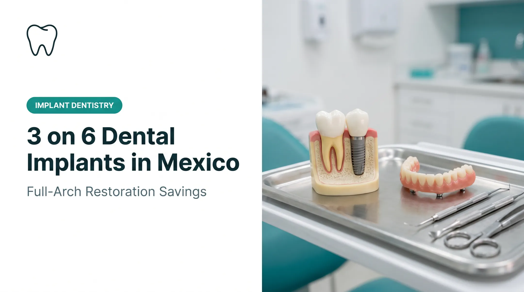 3 on 6 Dental Implants in Mexico