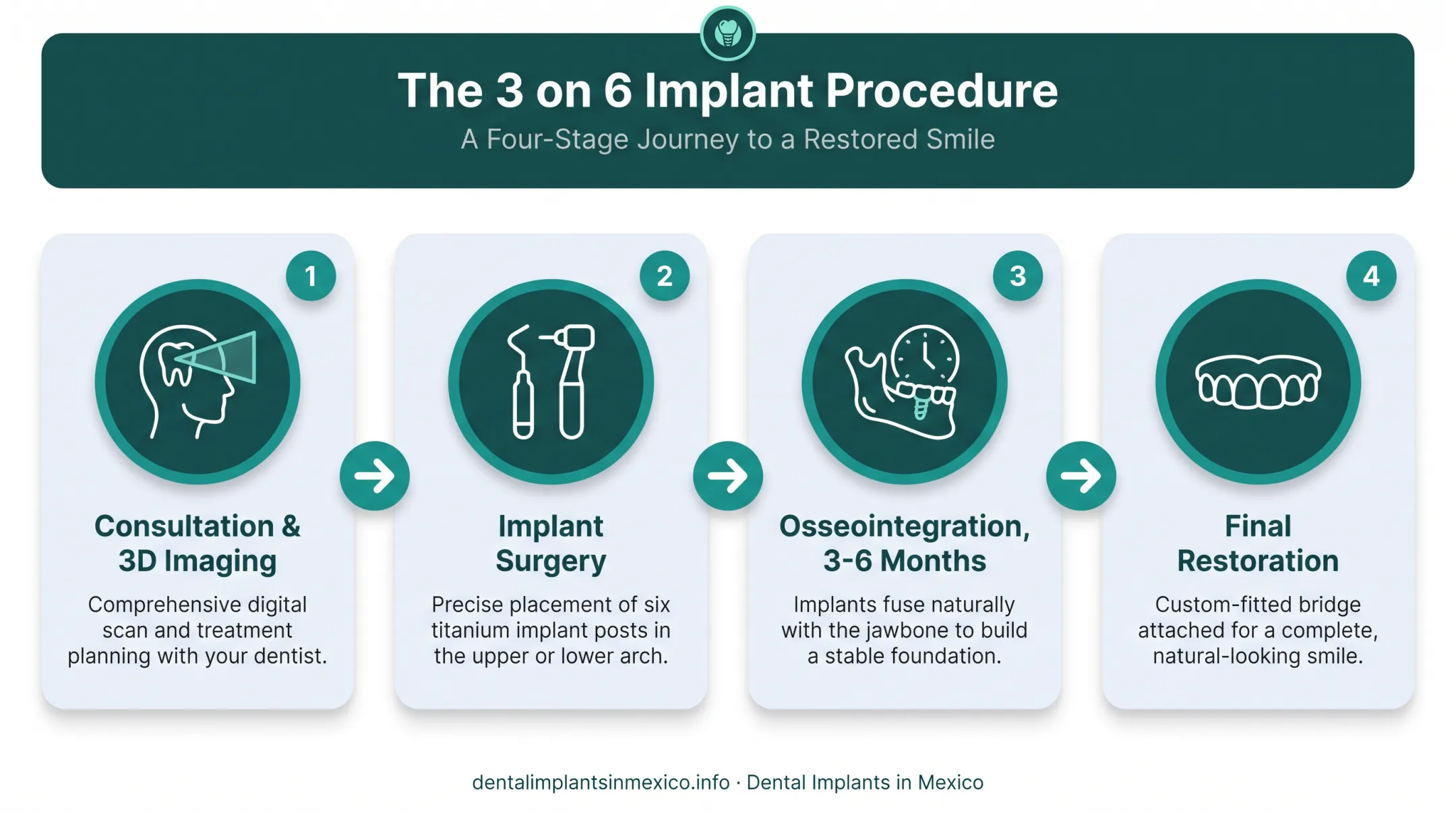 4-step 3 on 6 dental implant procedure timeline from consultation to final bridges