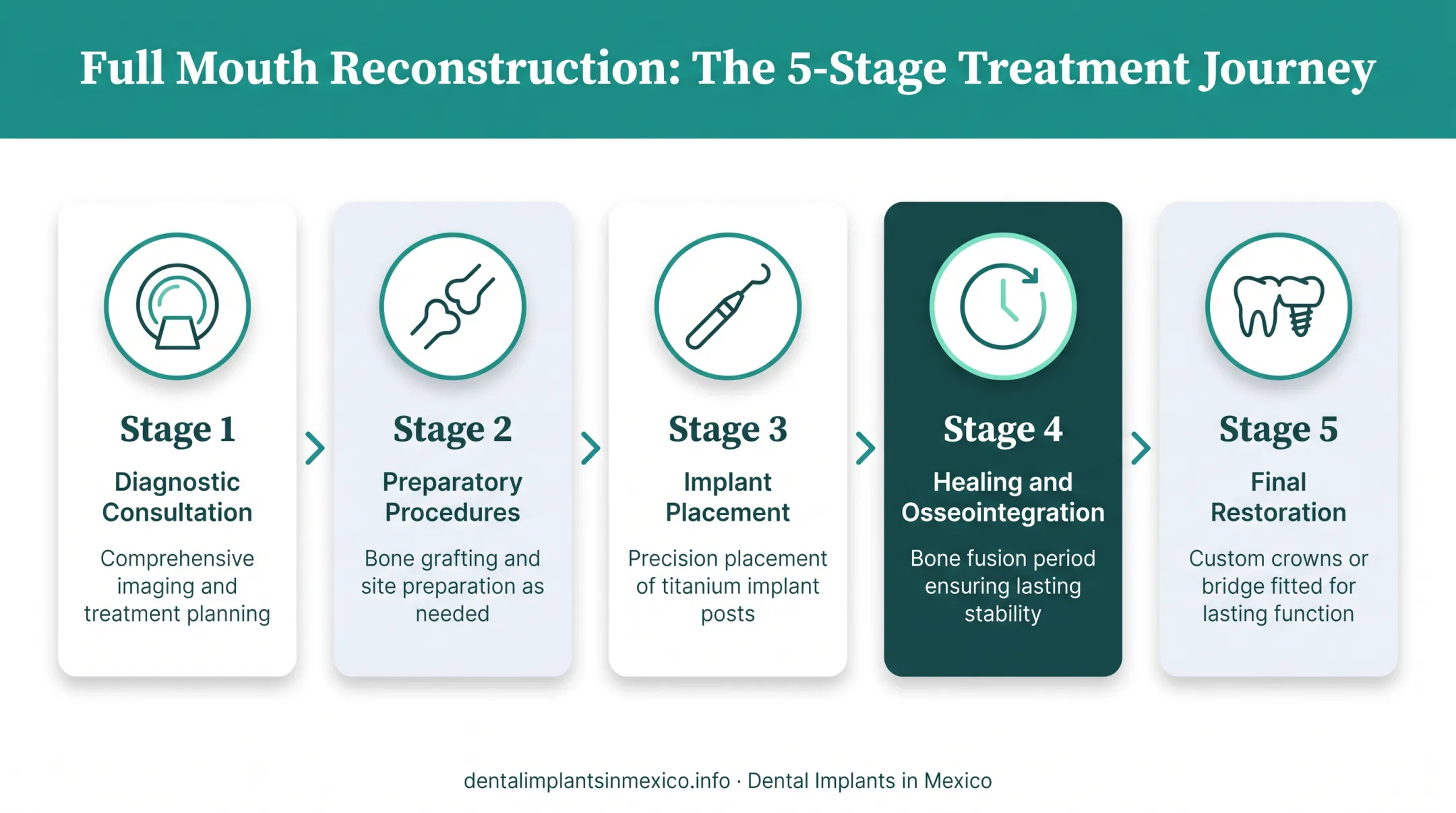 Five-step full mouth reconstruction process from consultation to final restoration
