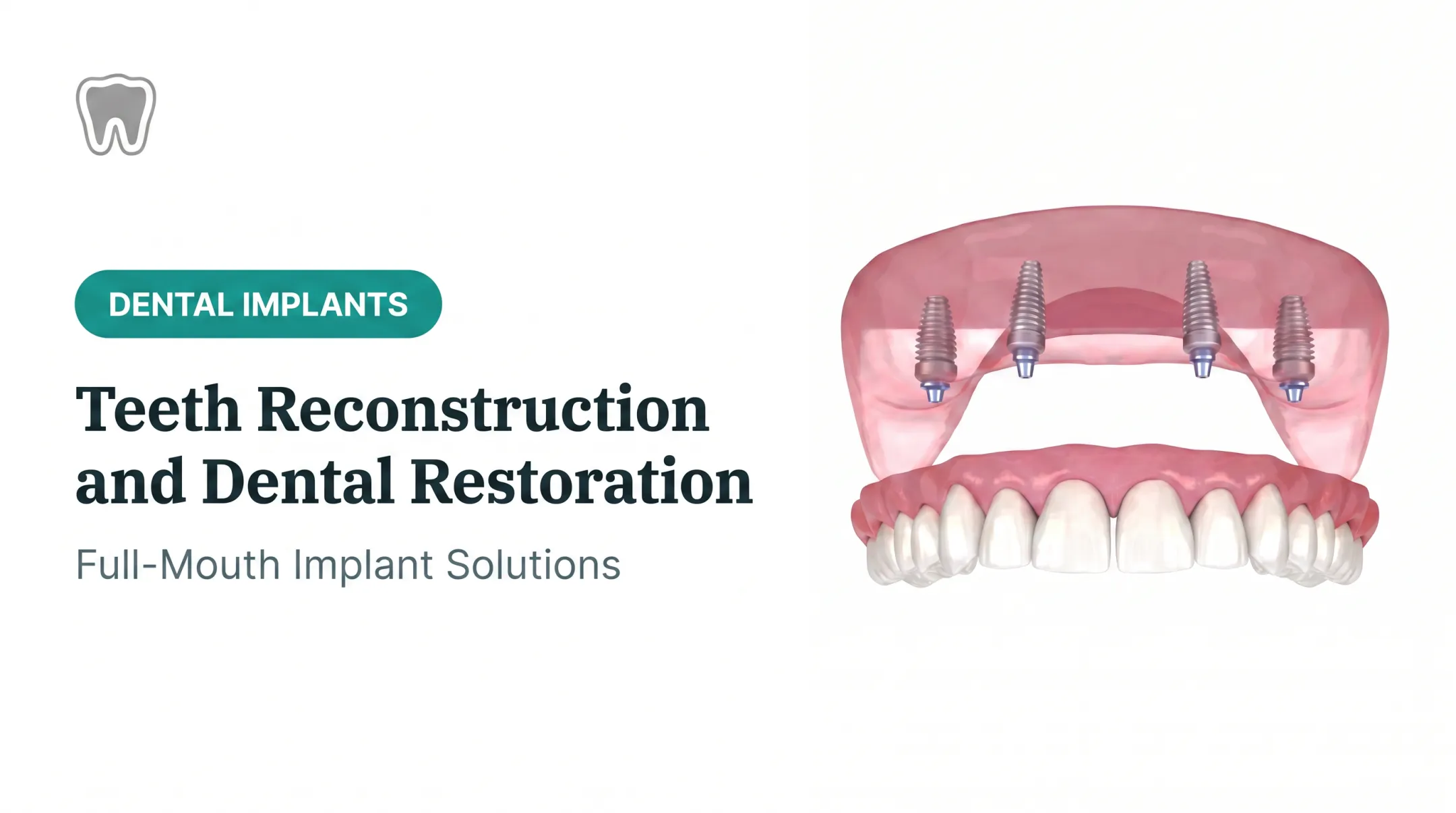 Teeth Reconstruction and Dental Restoration