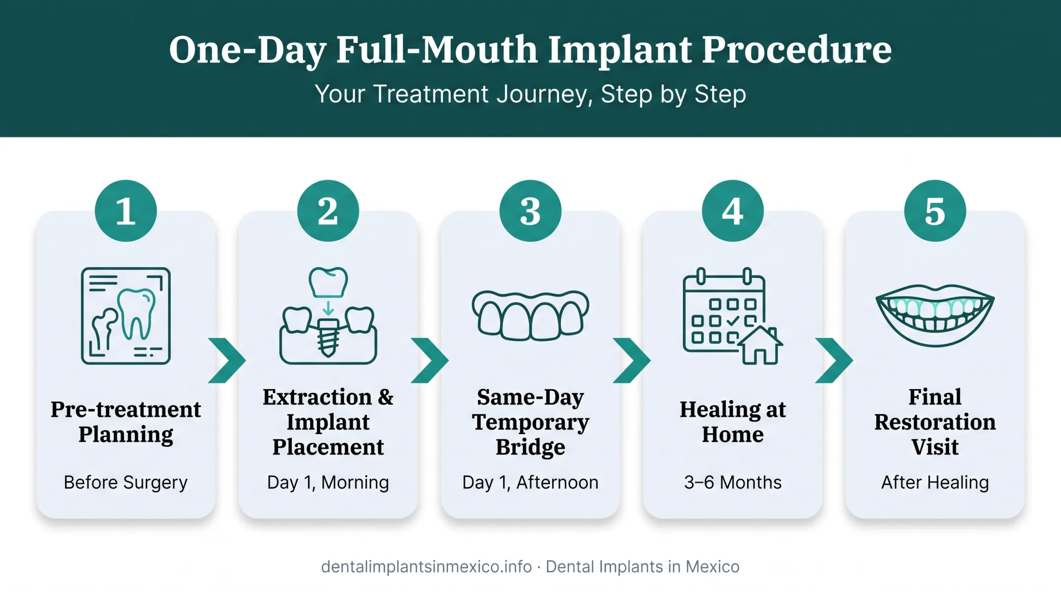Same-day full-mouth implant procedure steps from planning to final restoration