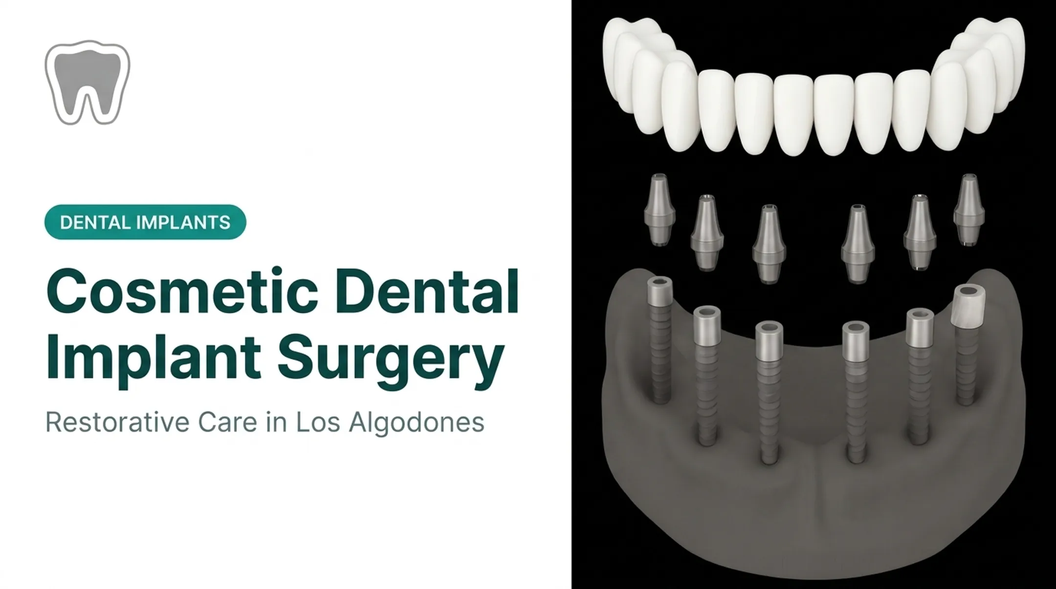 Cosmetic Dental Implant Surgery