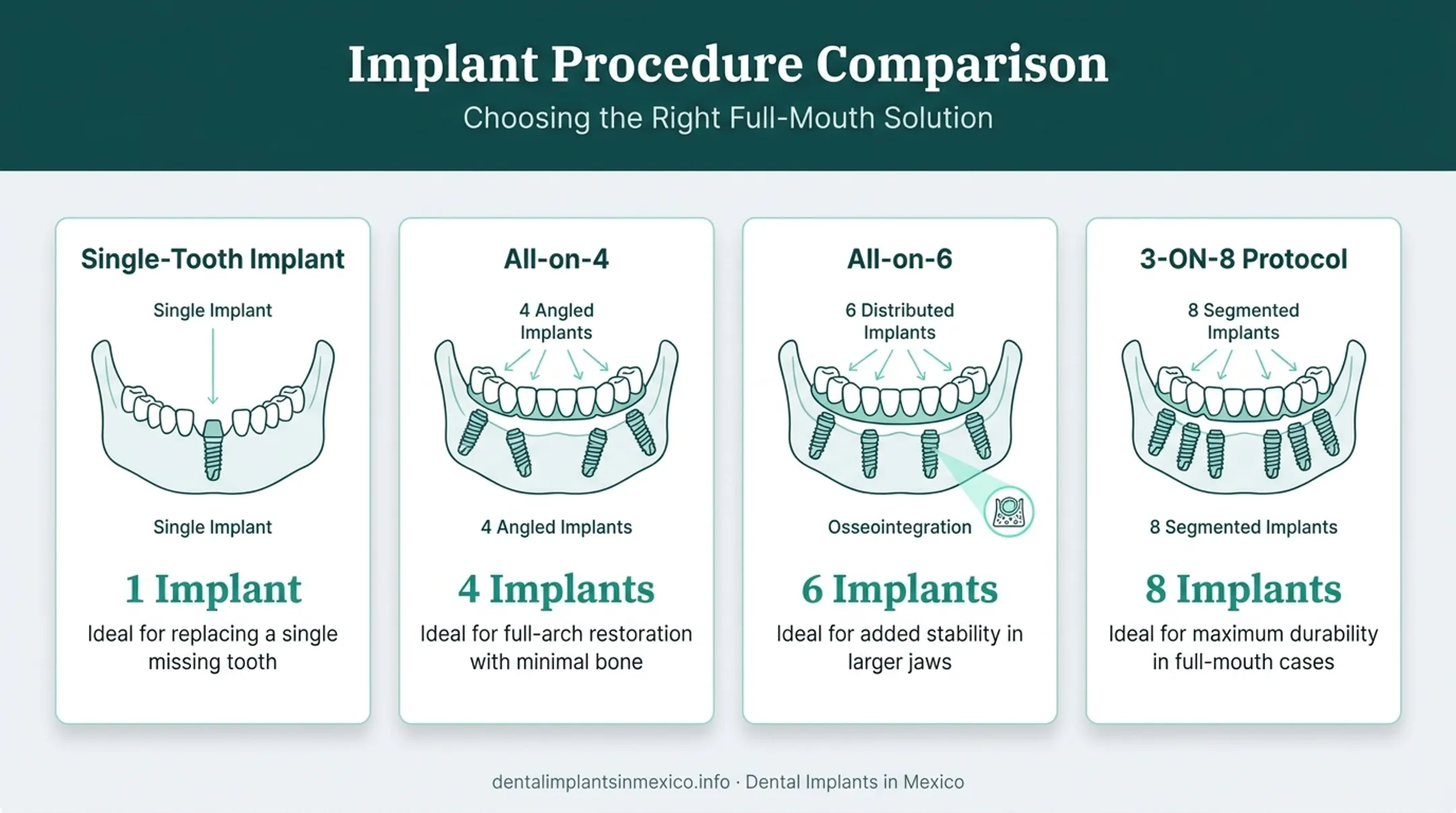 Comparison of single tooth All-on-4 All-on-6 and 3-ON-8 implant types
