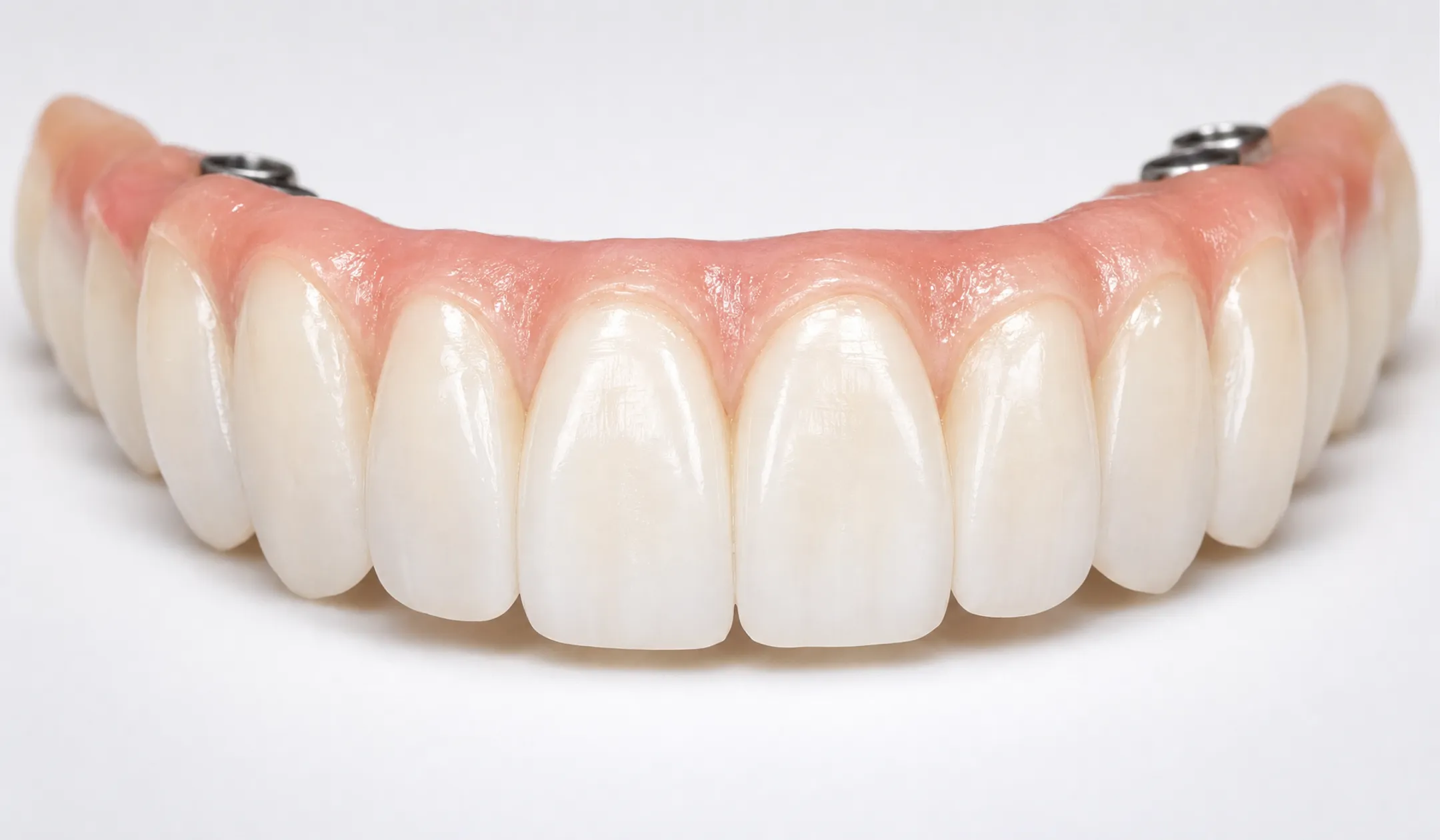 Close-up of natural-looking zirconia dental bridge with translucent tooth enamel
