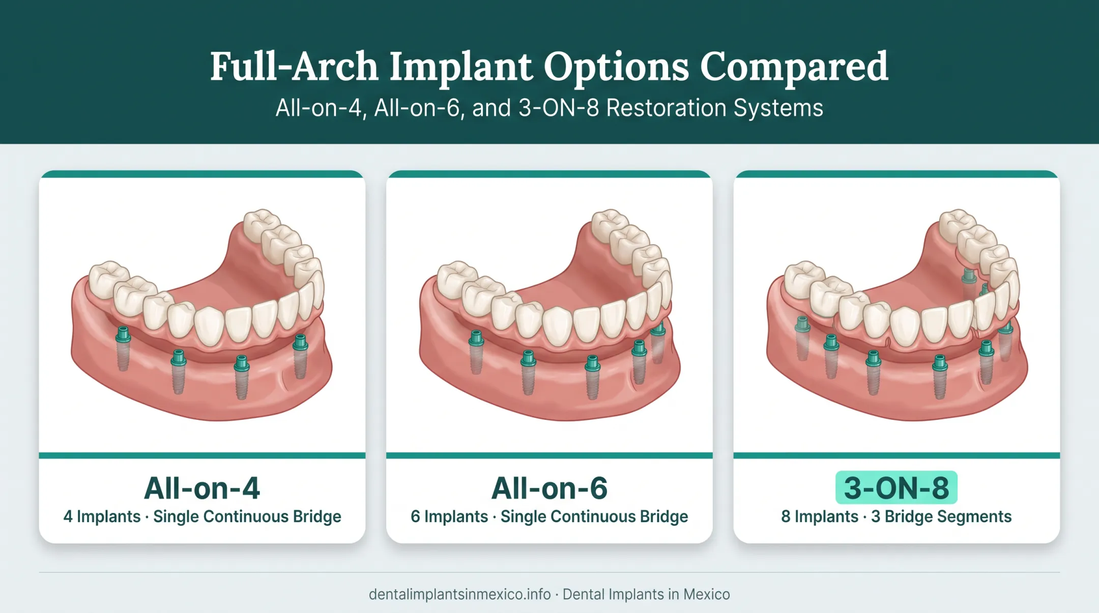 All-on-4 versus All-on-6 versus 3-ON-8 implant count comparison diagram