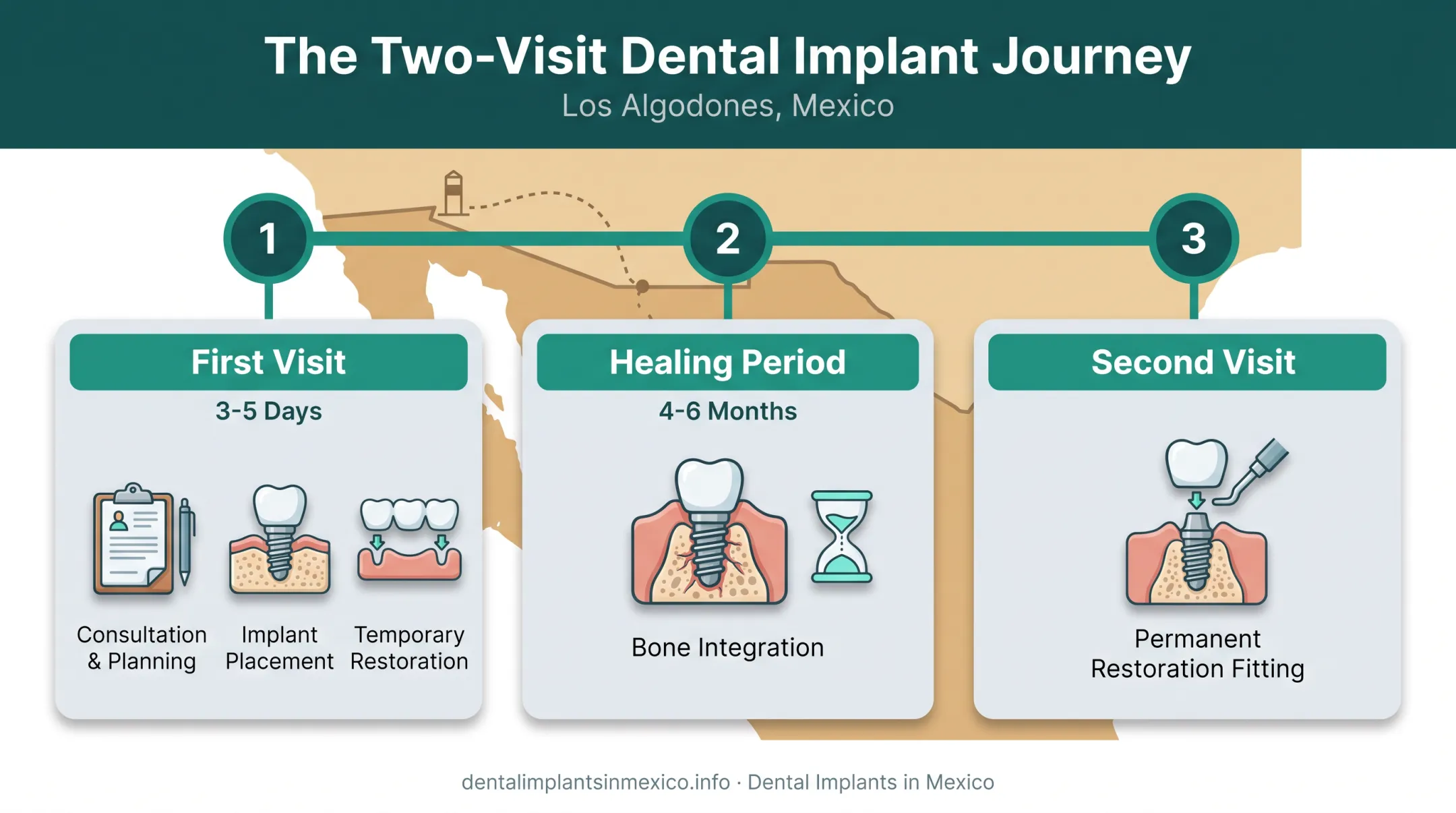 Two-visit treatment timeline for full mouth implants in Los Algodones Mexico