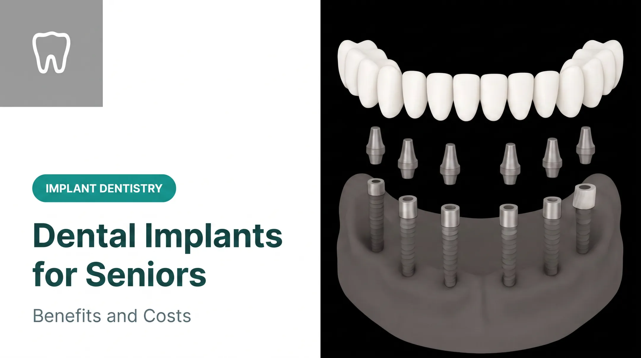Dental Implants for Seniors: Benefits and Costs