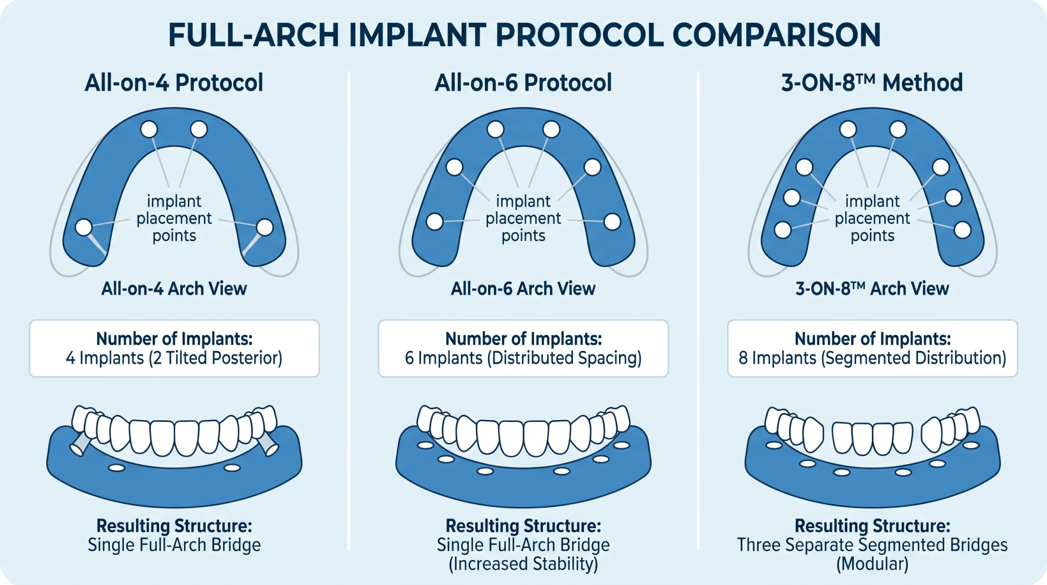 3-ON-8 dental implant protocol diagram showing eight implants per arch