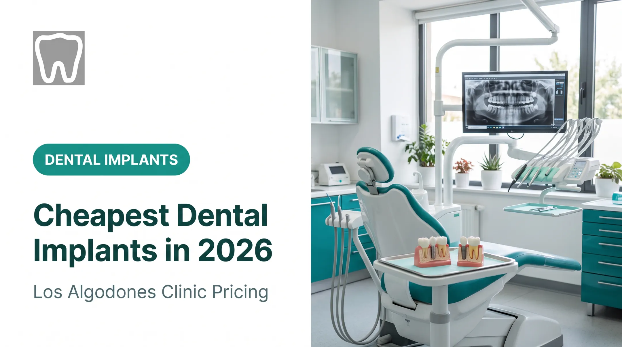 Cheapest Dental Implants in 2026