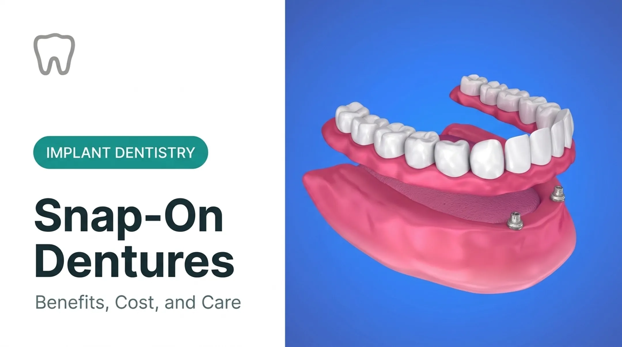 Snap-On Dentures: Benefits, Cost, and Care