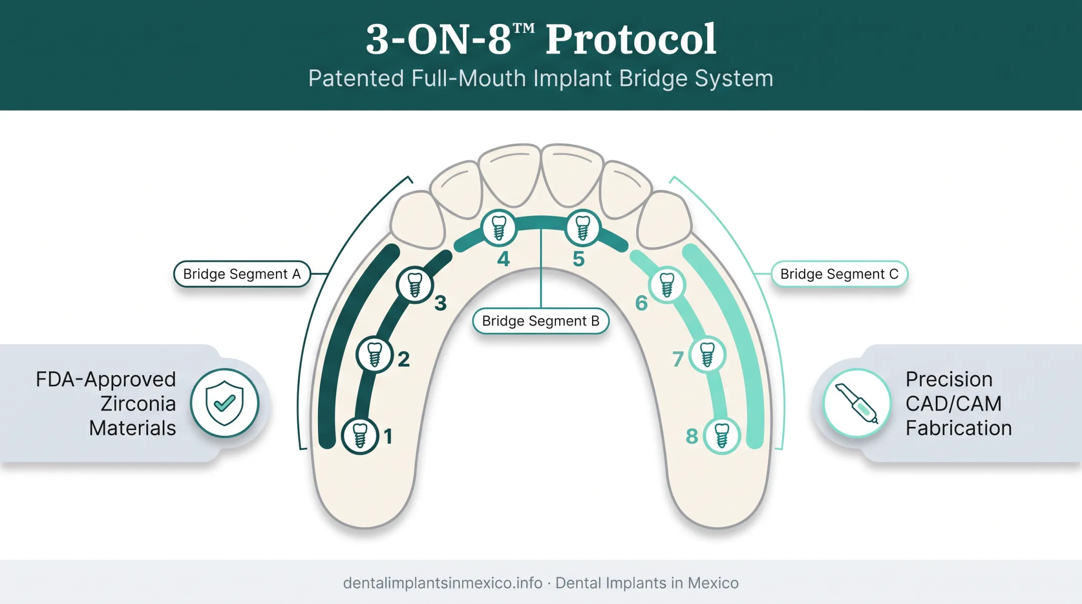 3-ON-8 protocol showing eight implants and three zirconia bridges