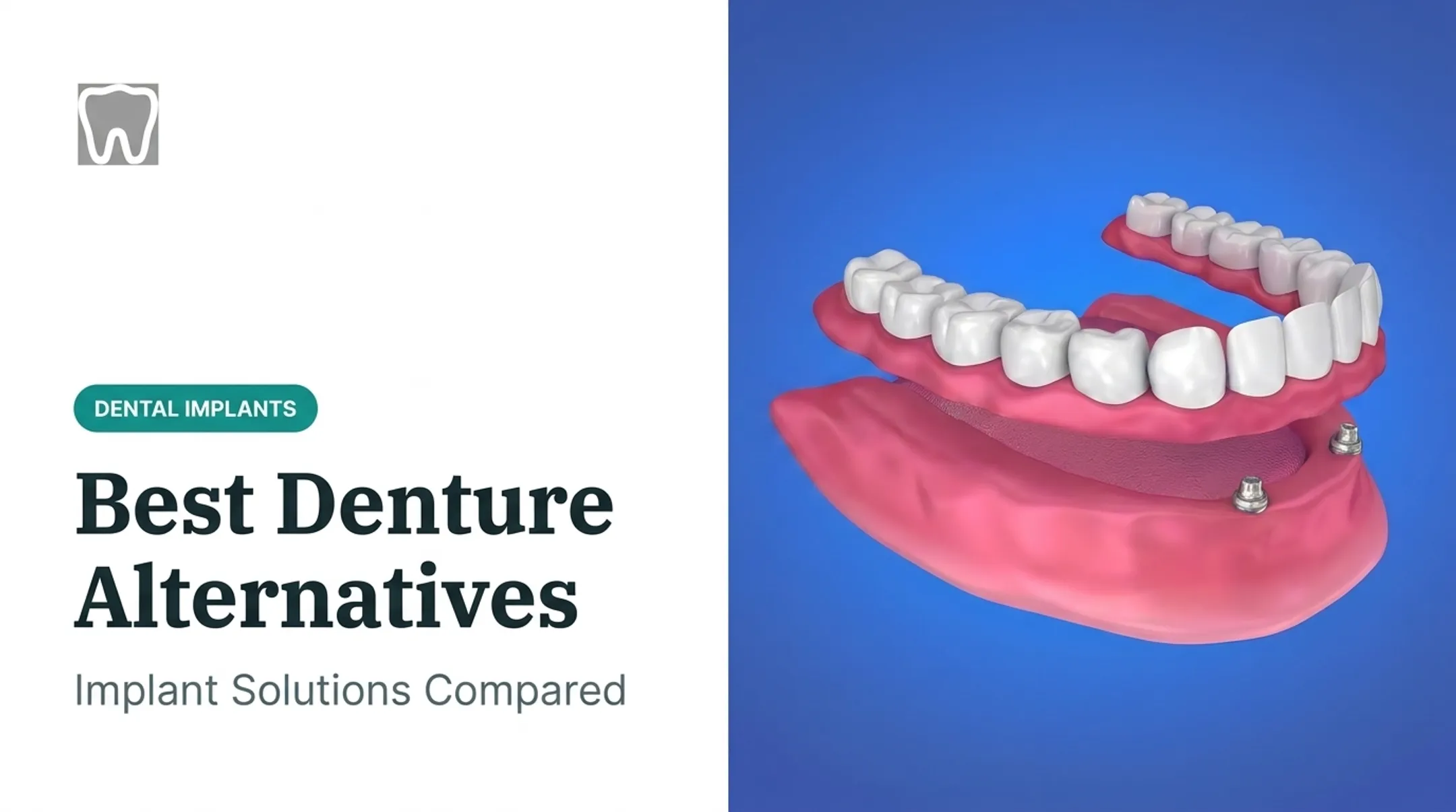 Best Denture Alternatives