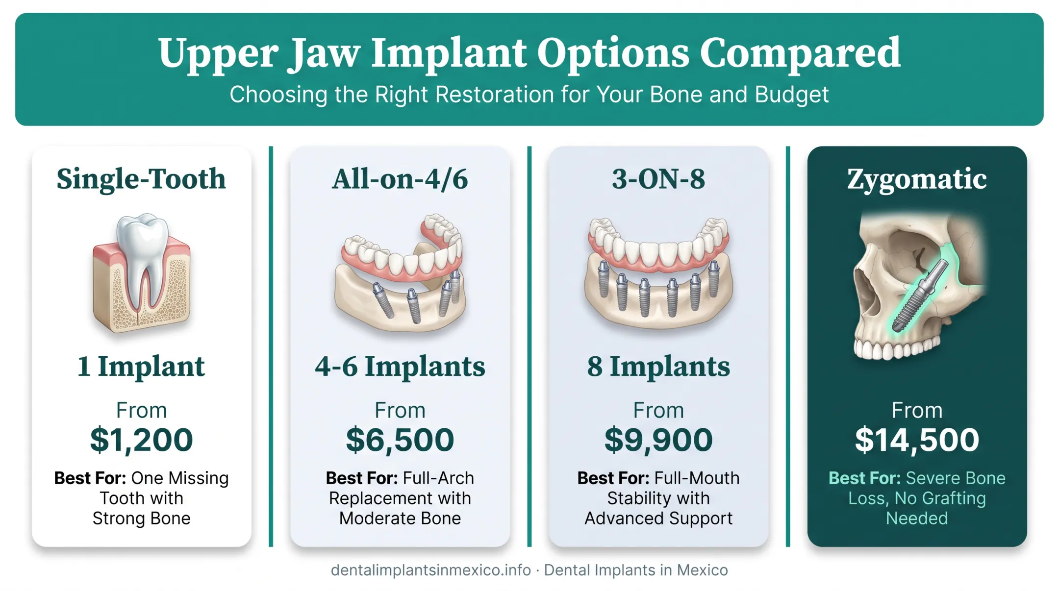Upper jaw implant types comparison chart by implant count and bone requirement