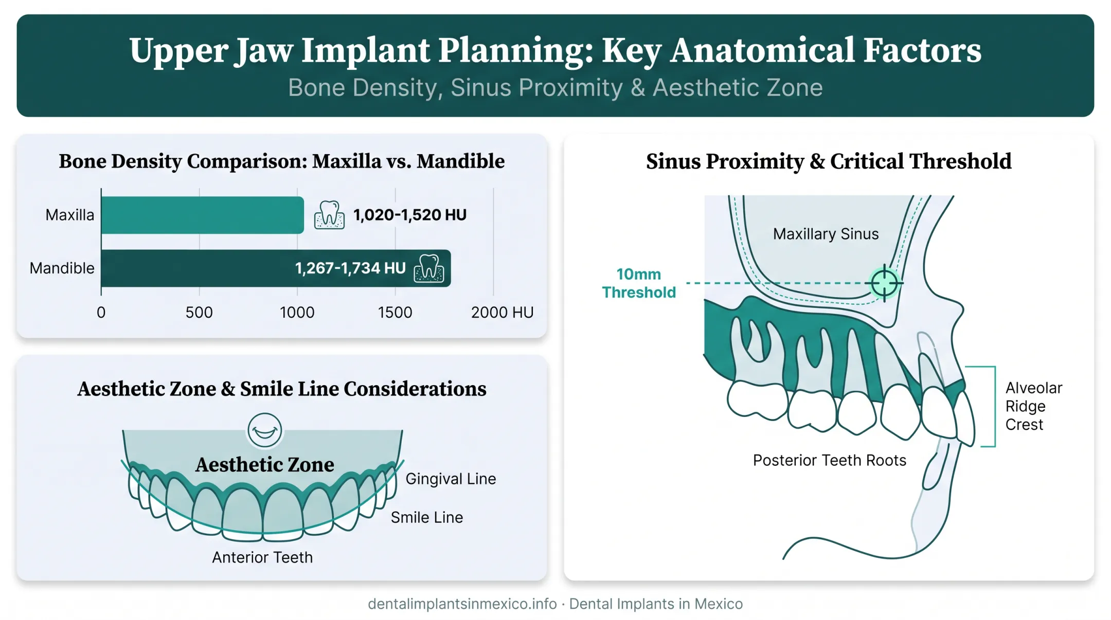 Upper jaw bone density sinus proximity CBCT evaluation factors diagram