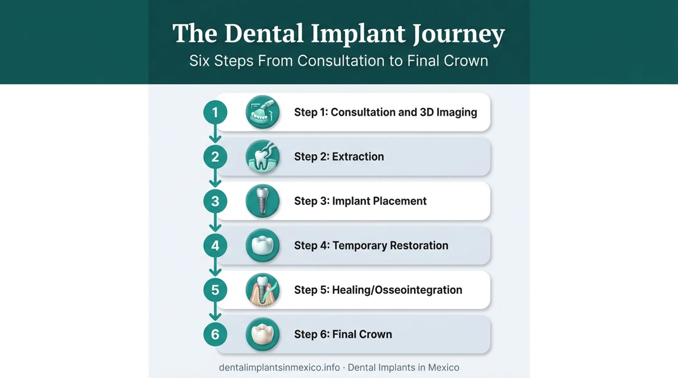 6-step same-day dental implant procedure from consultation to final crown