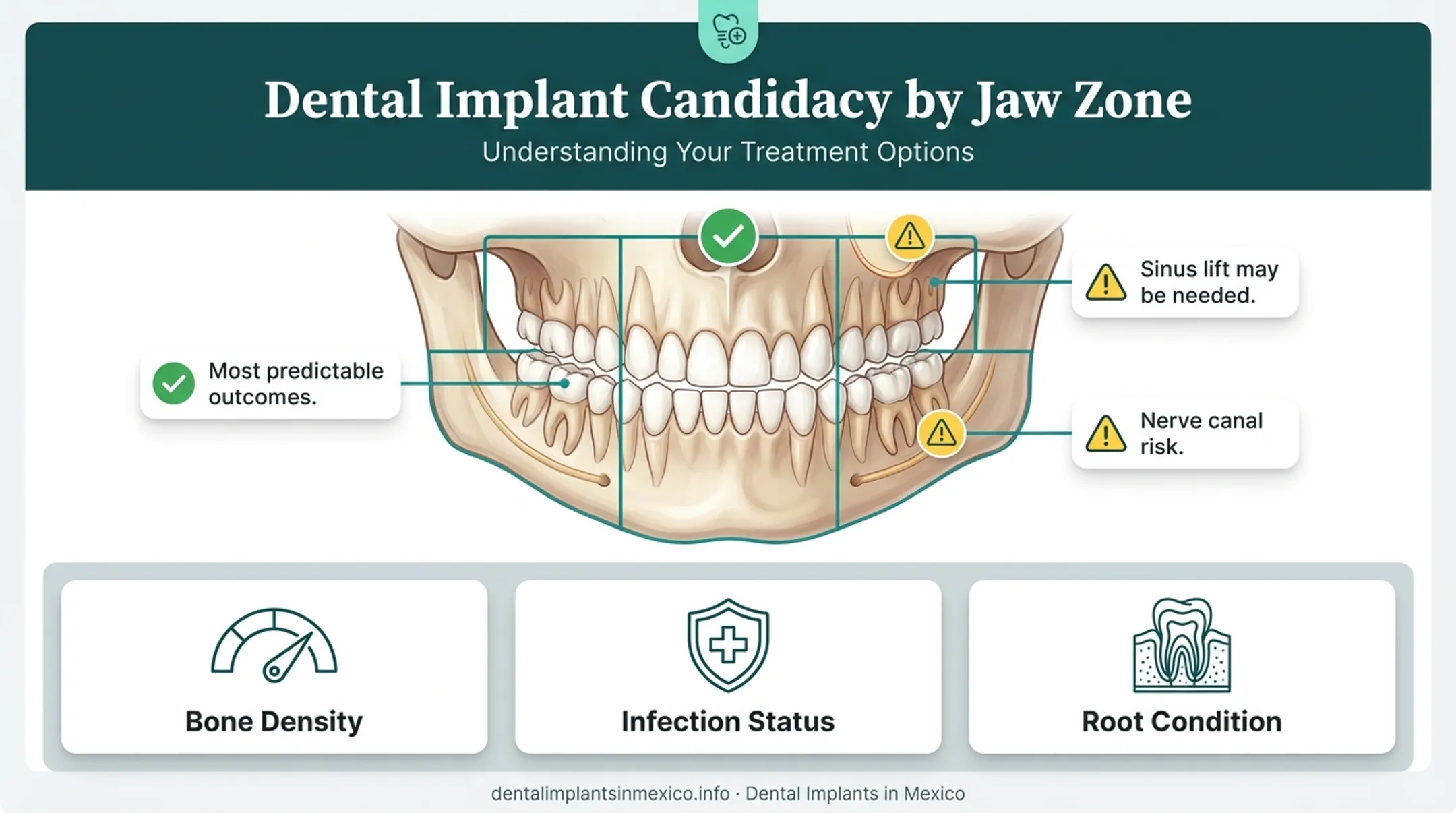Dental implant candidacy factors by tooth location and bone condition
