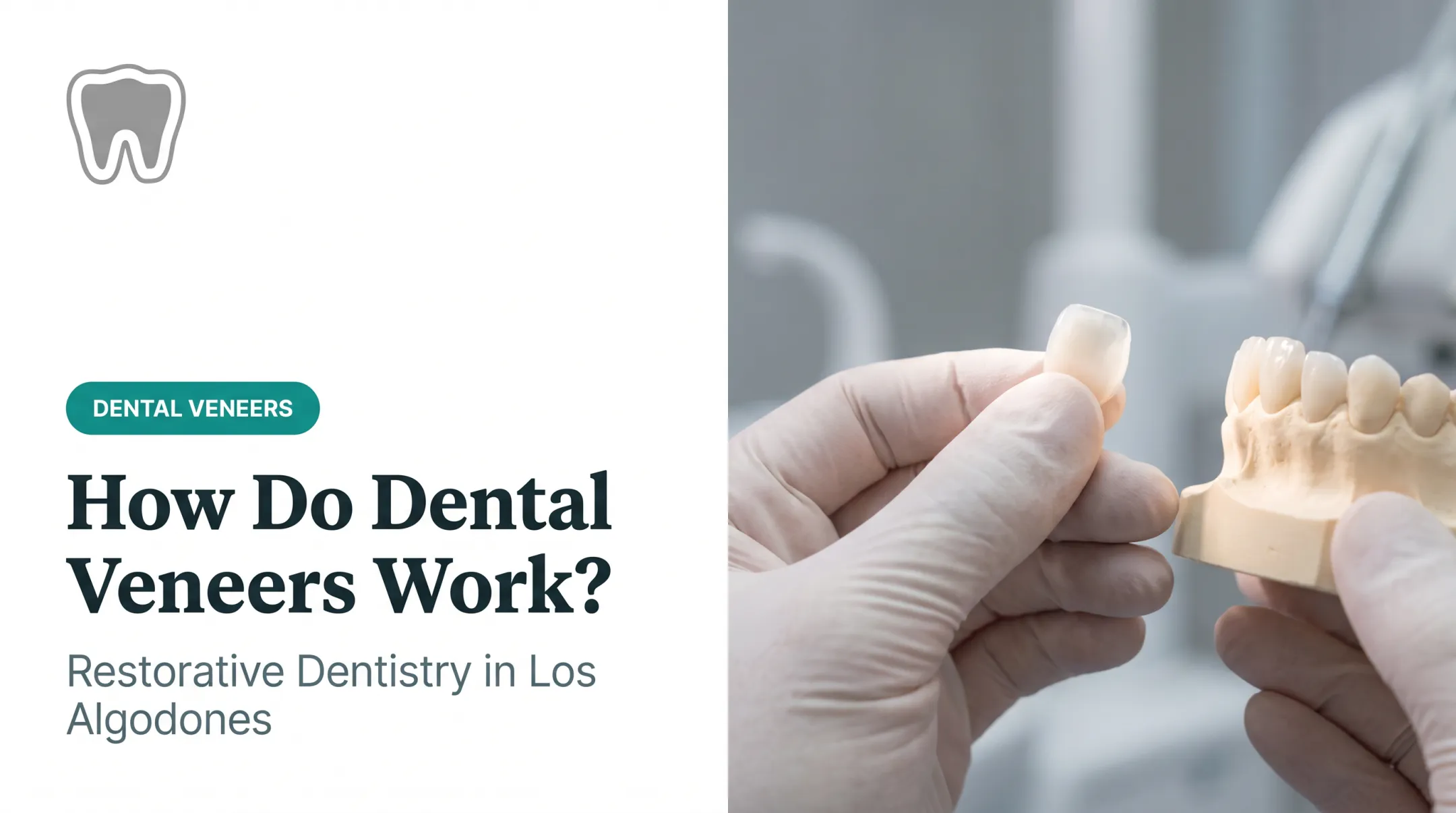 How Do Dental Veneers Work?