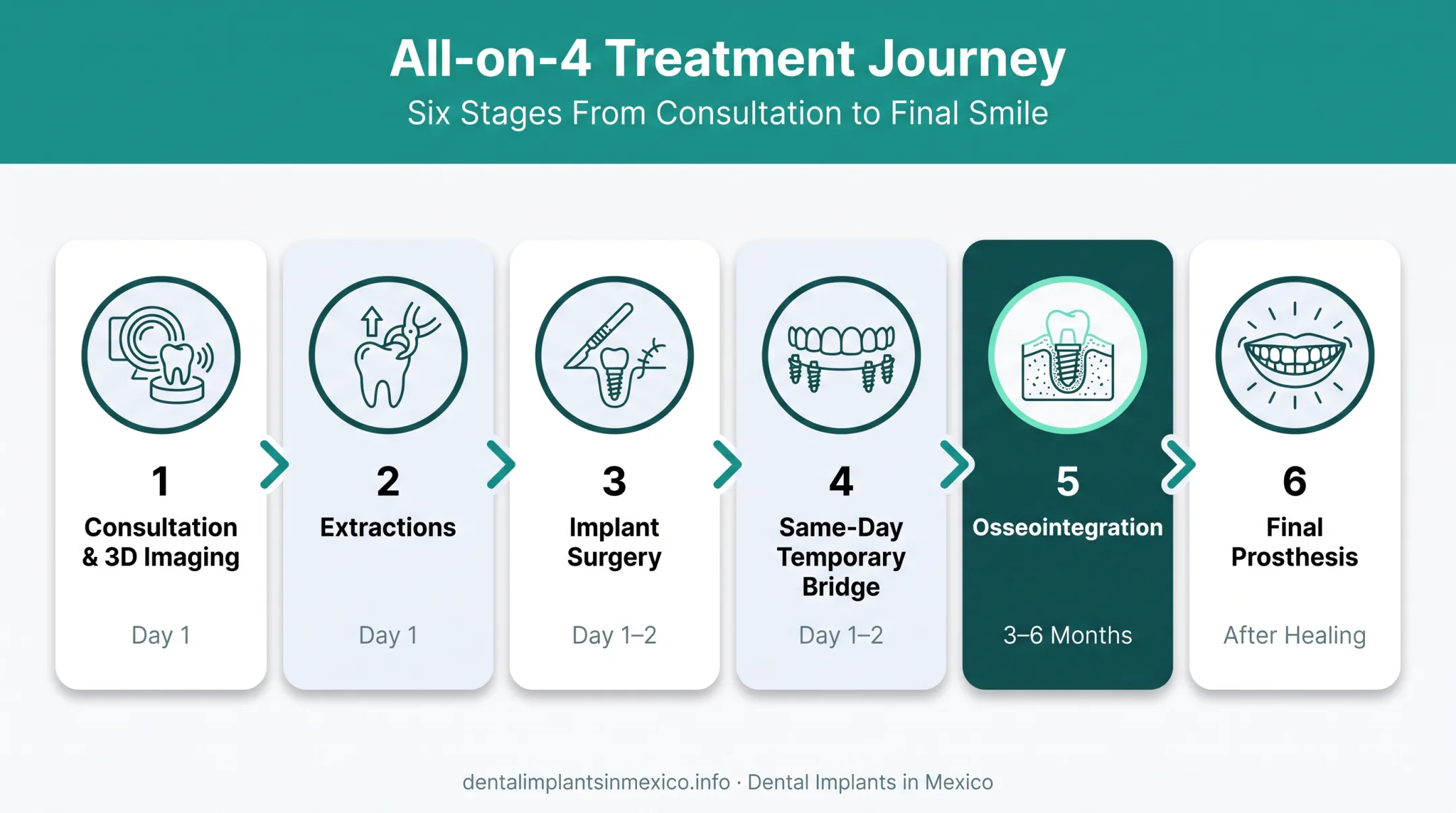 Six-step All-on-4 treatment timeline from consultation to final prosthesis