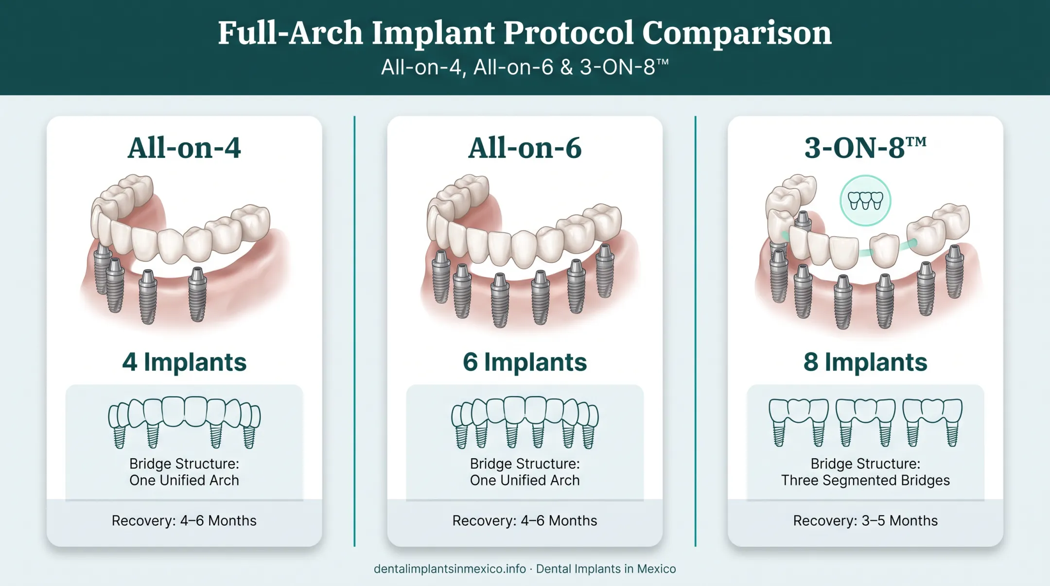 All-on-4 All-on-6 and 3-ON-8 implant protocols comparison