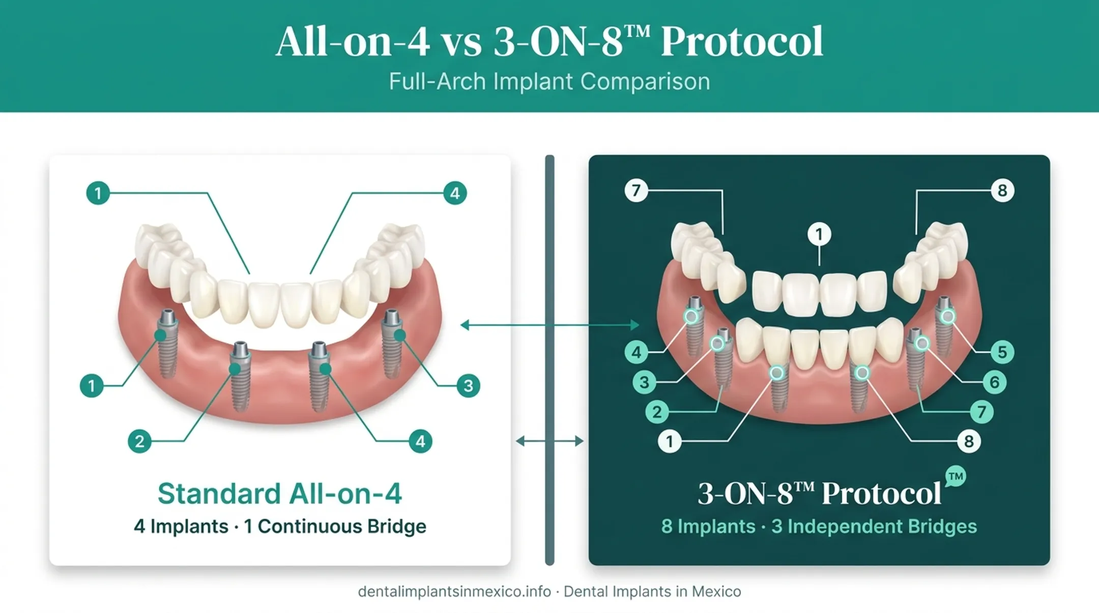 Standard All-on-4 versus 3-ON-8 protocol structural comparison diagram