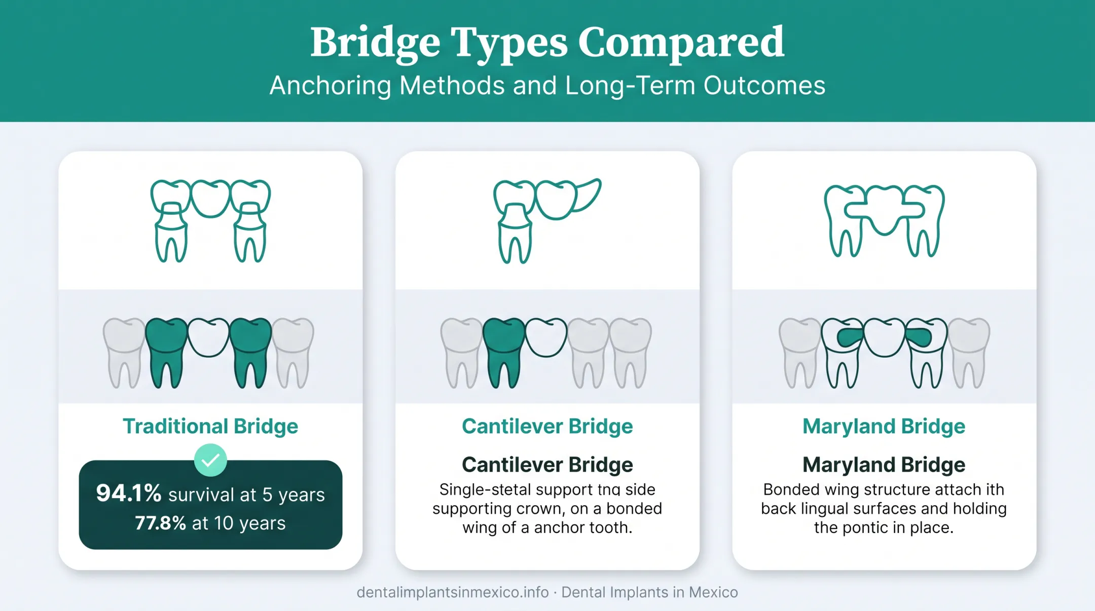 Comparison of three dental bridge types and survival rates
