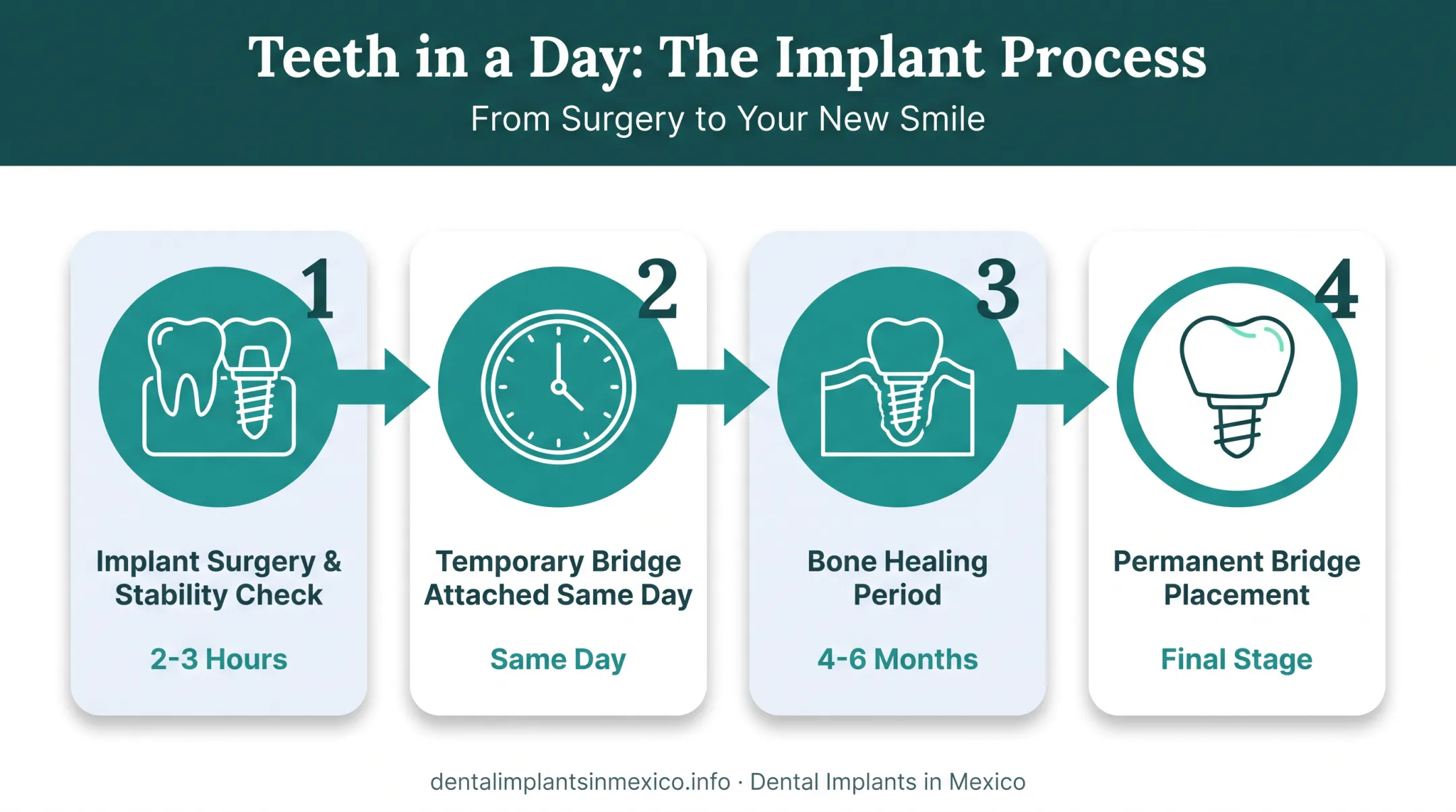 Immediate load implant timeline from surgery to permanent bridge placement