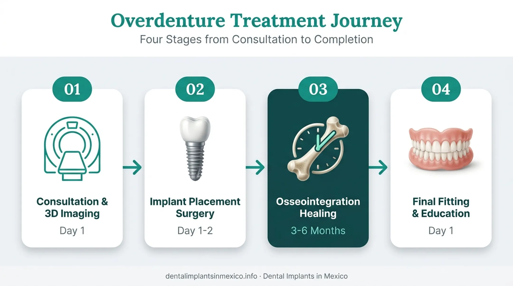 Four-step overdenture treatment process from consultation to final fitting