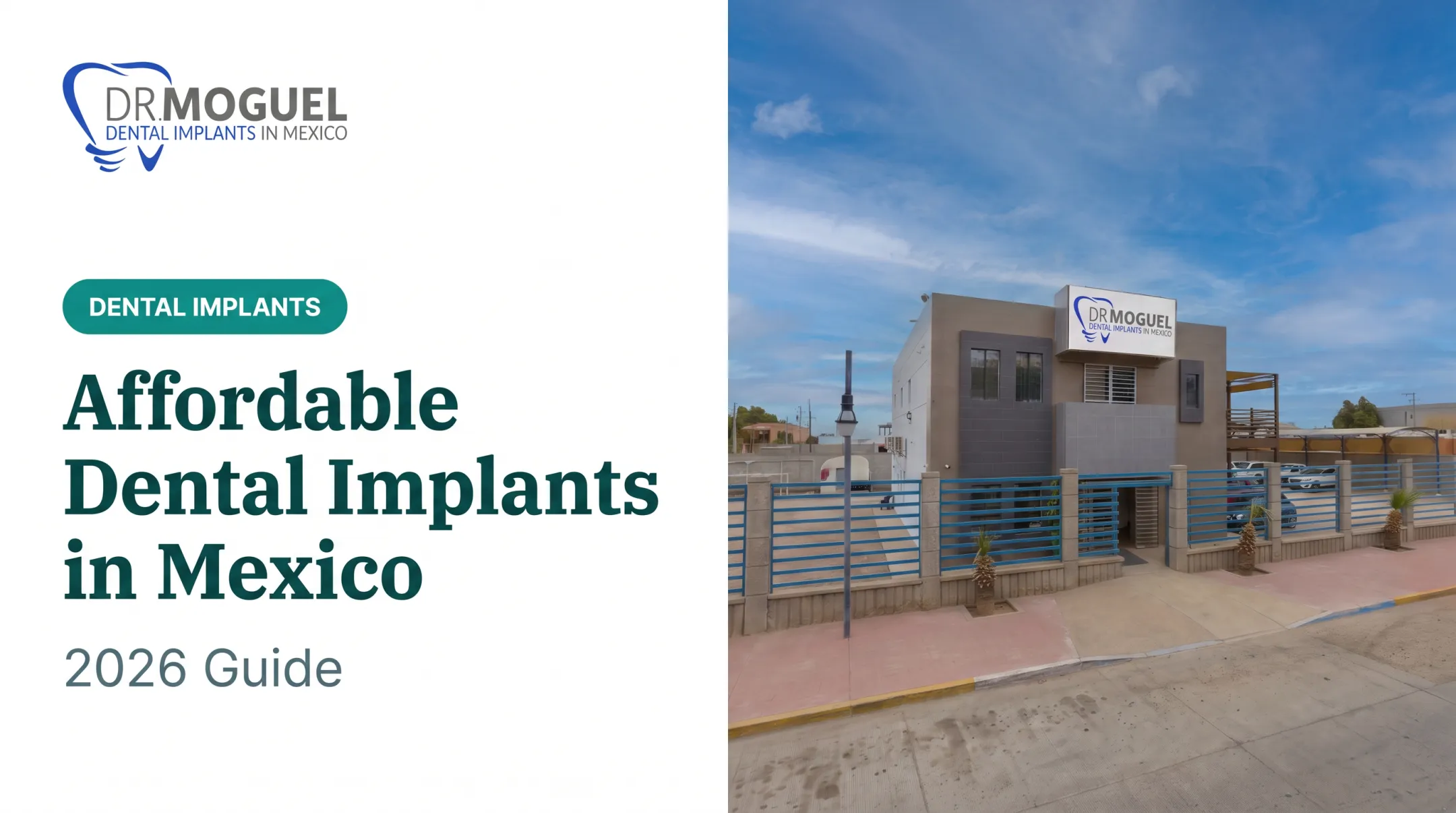 Affordable Dental Implants in Mexico: 2026 Guide