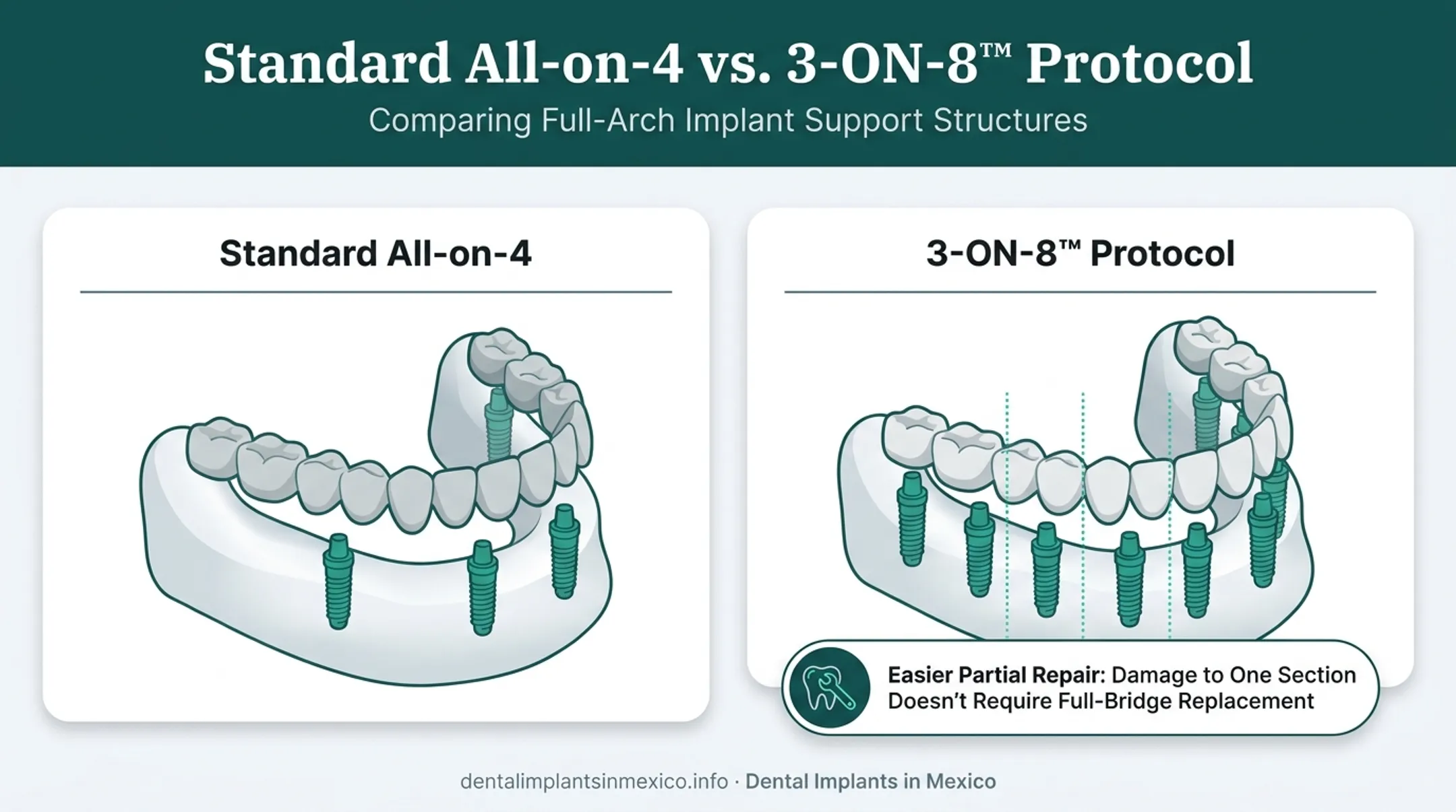 3-ON-8 protocol versus standard All-on-4 bridge design comparison