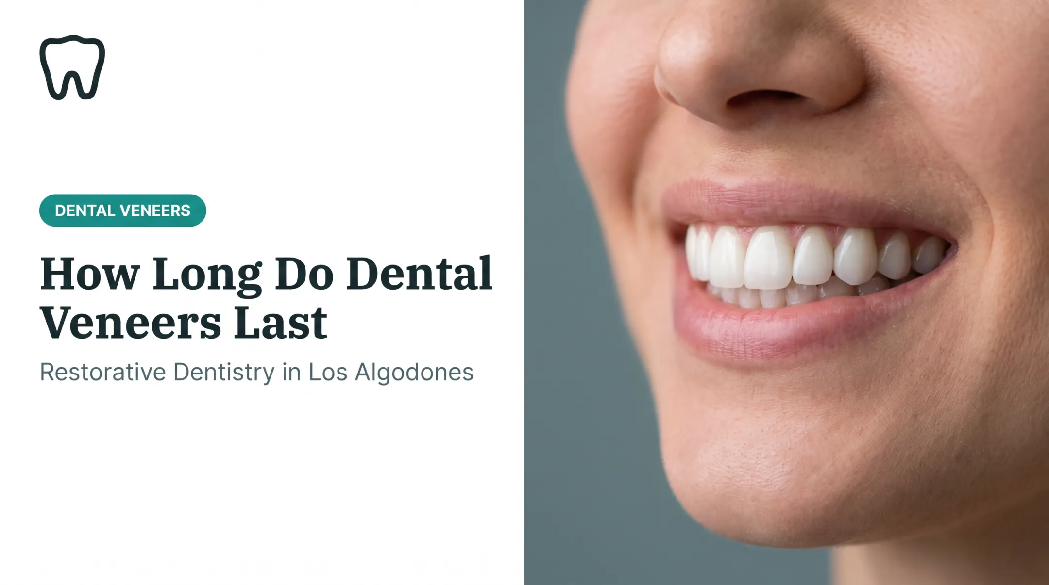 How Long Do Dental Veneers Last