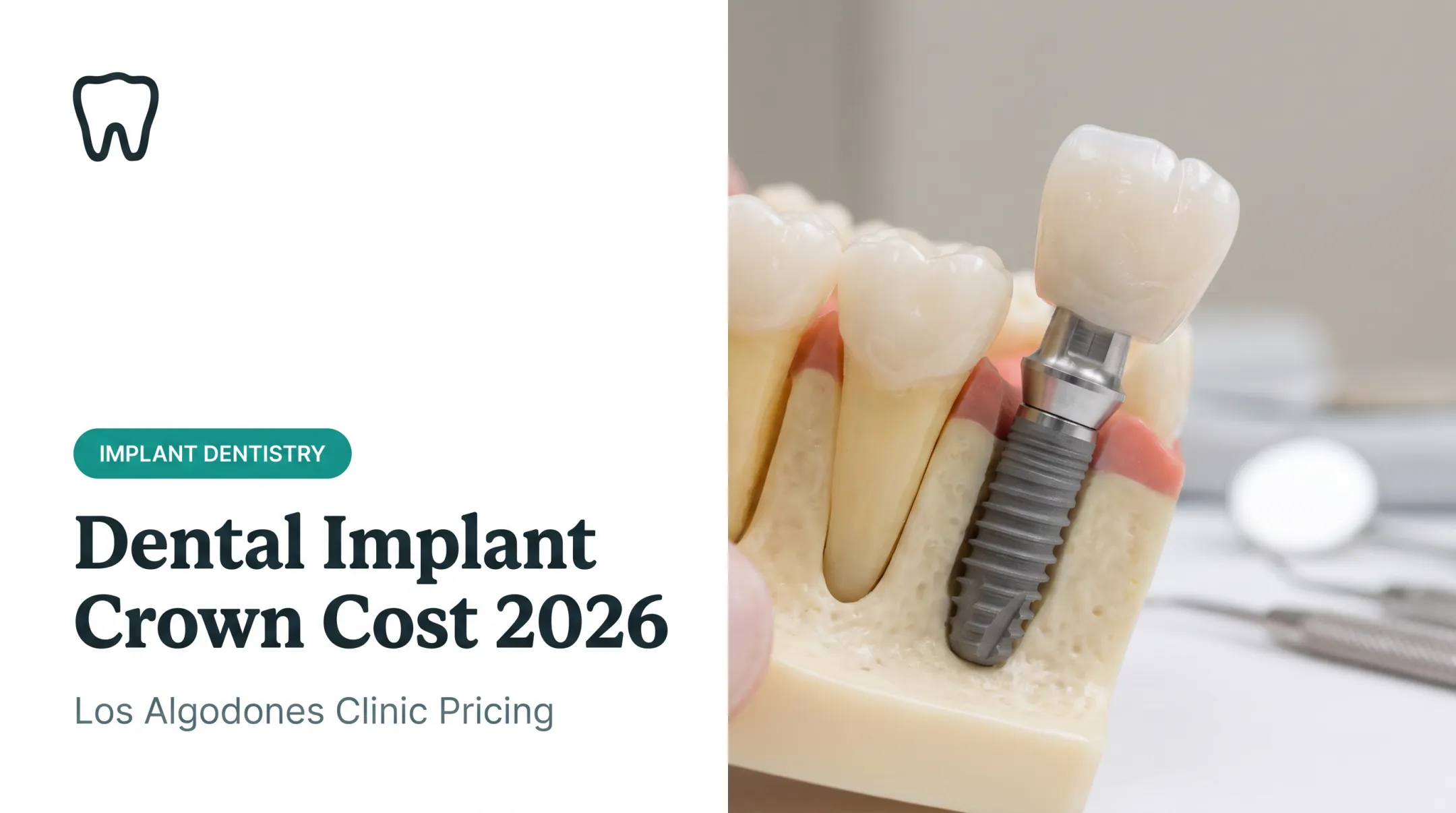 Dental Implant Crown Cost 2026