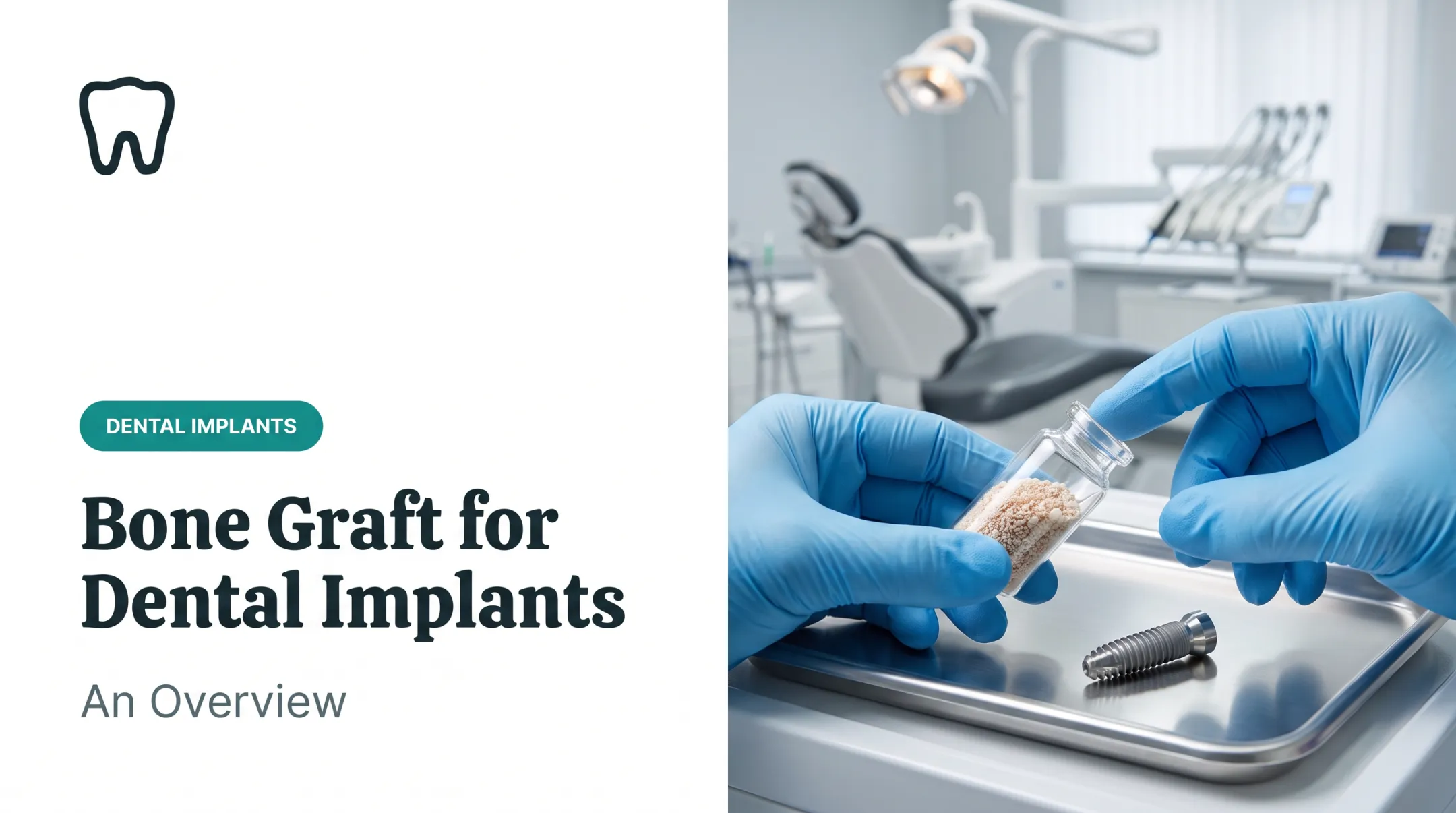 Bone Graft for Dental Implants: An Overview