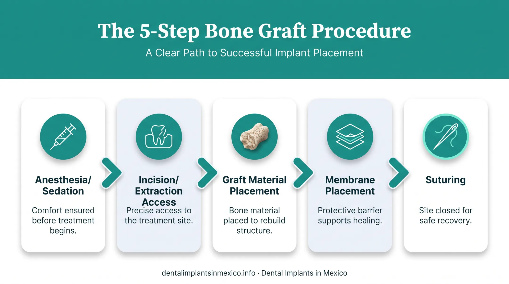 5-step dental bone graft surgical procedure sequence