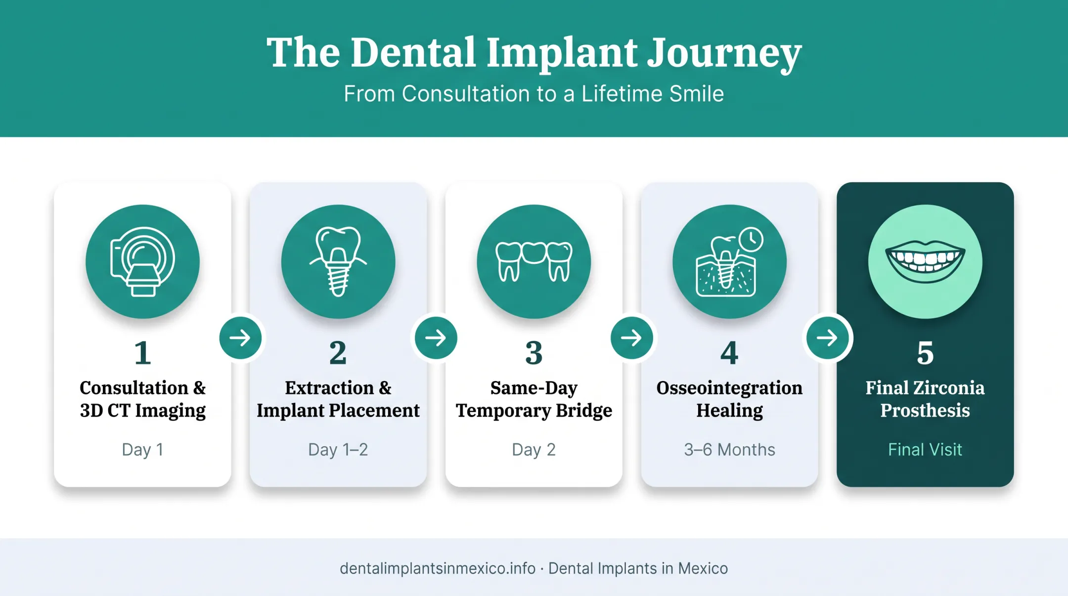 5-step All-on-4 dental implant treatment process from consultation to final prosthesis