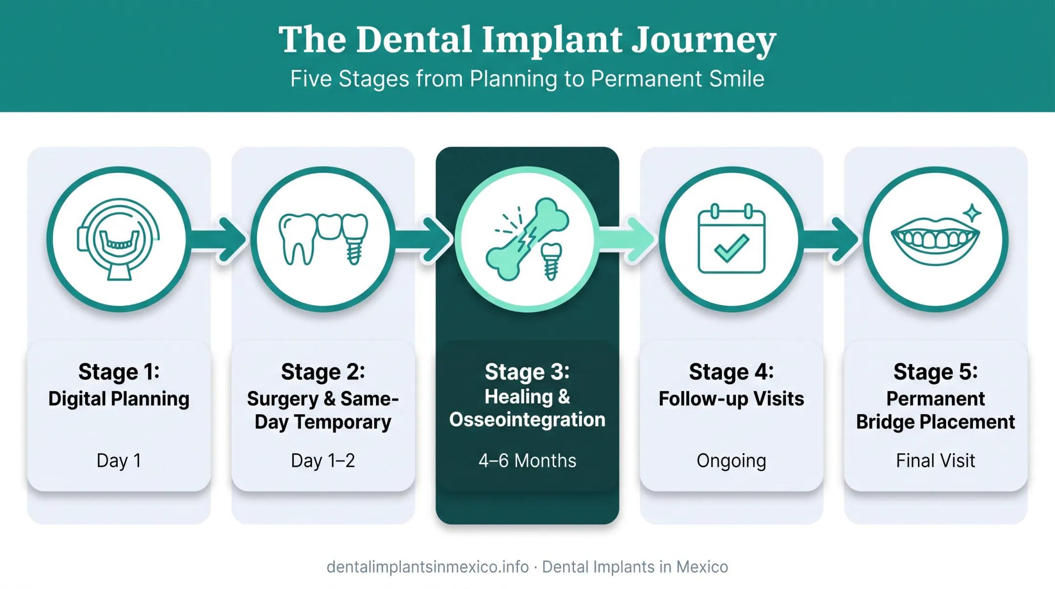 All-on-6 dental implant treatment timeline from surgery to permanent bridge
