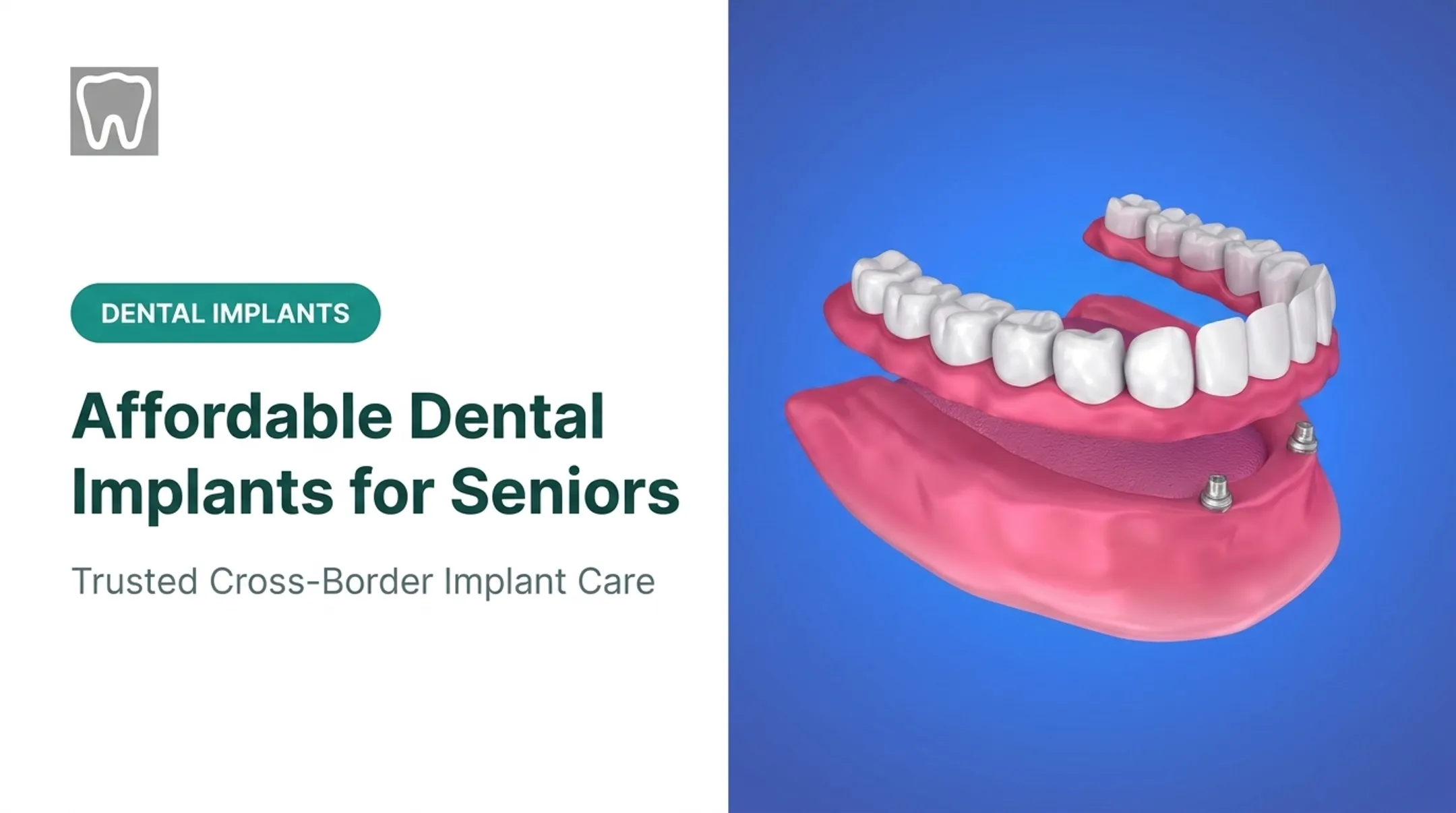 Affordable Dental Implants for Seniors