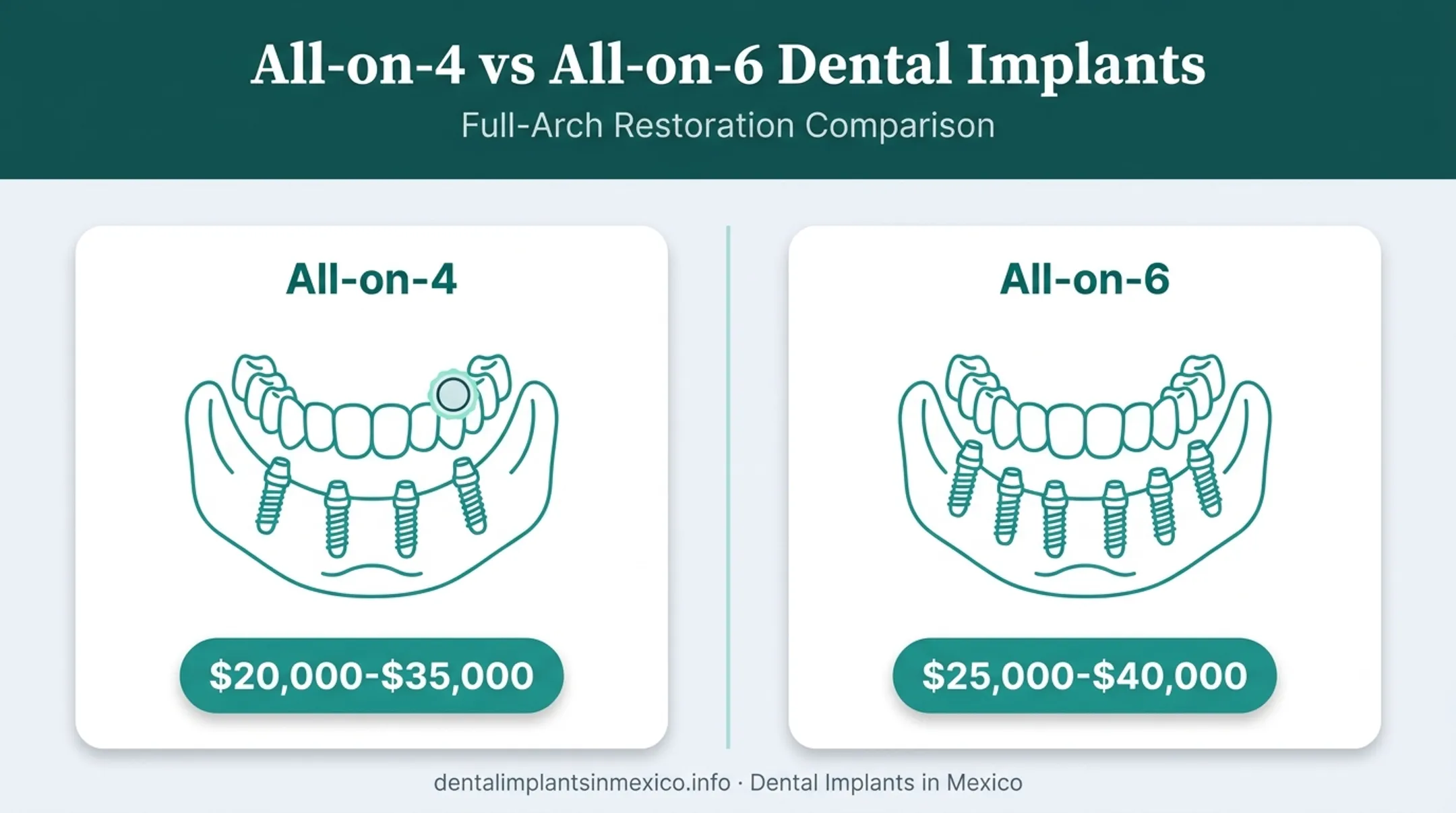 All-on-4 versus All-on-6 dental implant cost comparison chart